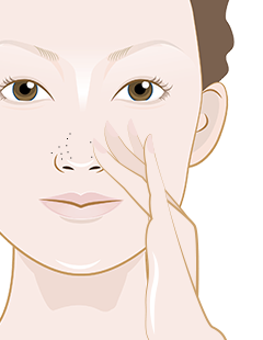 Mitesser kommen immer wieder? Erfahre, warum Ausdrücken der Haut schadet und wie chemisches Peeling mit Salicylsäure Mitesser sanft reduziert.