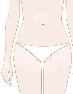 Ultimative Anleitung zum Brazilian Waxing: Schritt-für-Schritt-Behandlung und Produkte