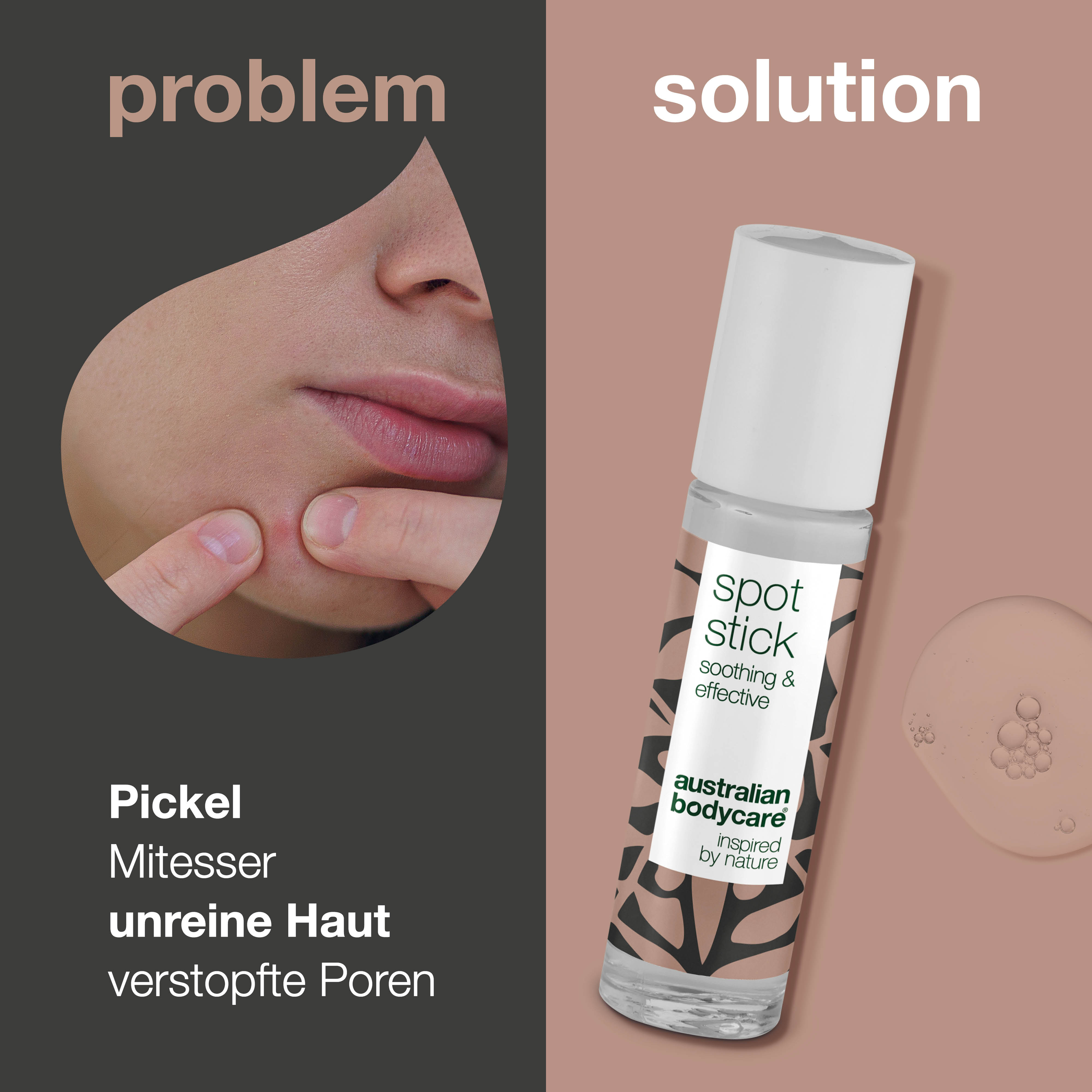 Anti Pickel Stift mit Teebaumöl — Pickelstift mit Teebaumöl | Gegen Pickel am Kinn und zur Pflege bei Akne im Gesicht