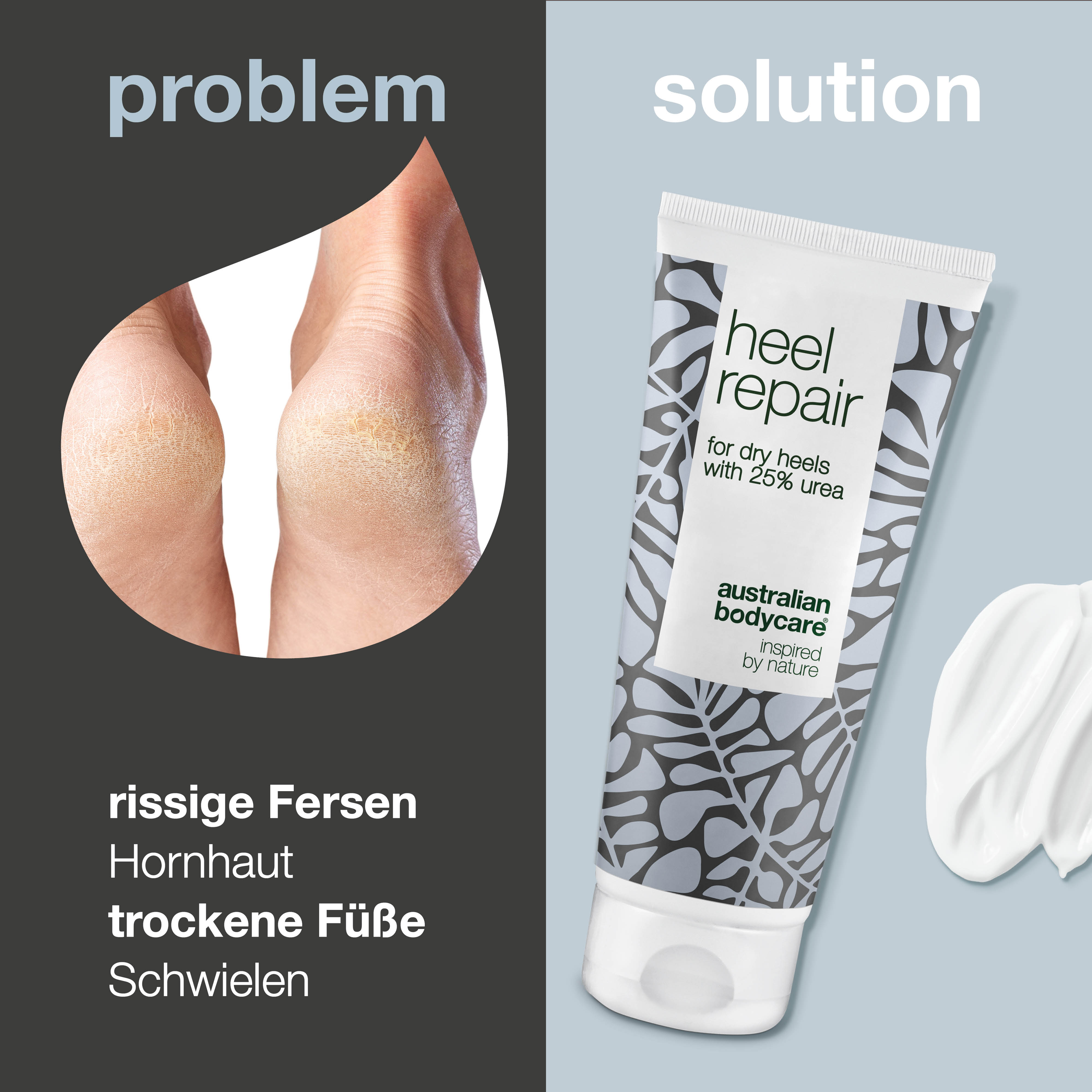 Anti Hornhaut Intensiv Creme mit 25 % Urea — Schrundensalbe für rissige Fersen