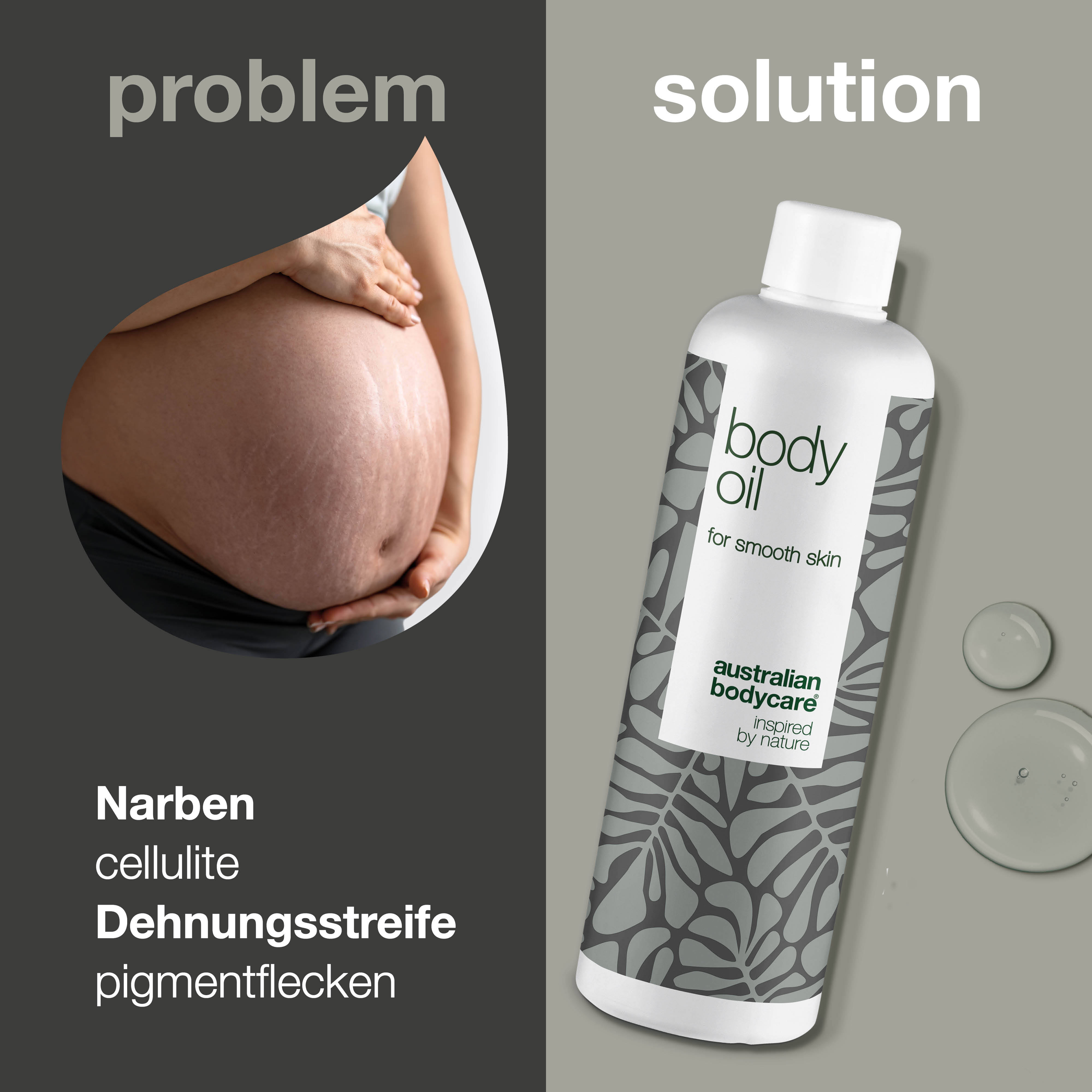 Body Oil – Reduziert Dehnungsstreifen, Narben und Pigmentflecken — Body Oil reduziert Dehnungsstreifen, Narben und Pigmentflecken. Mit Mandelöl, Squalan und Vitamin E für eine hydratisierte, geschmeidige Haut.