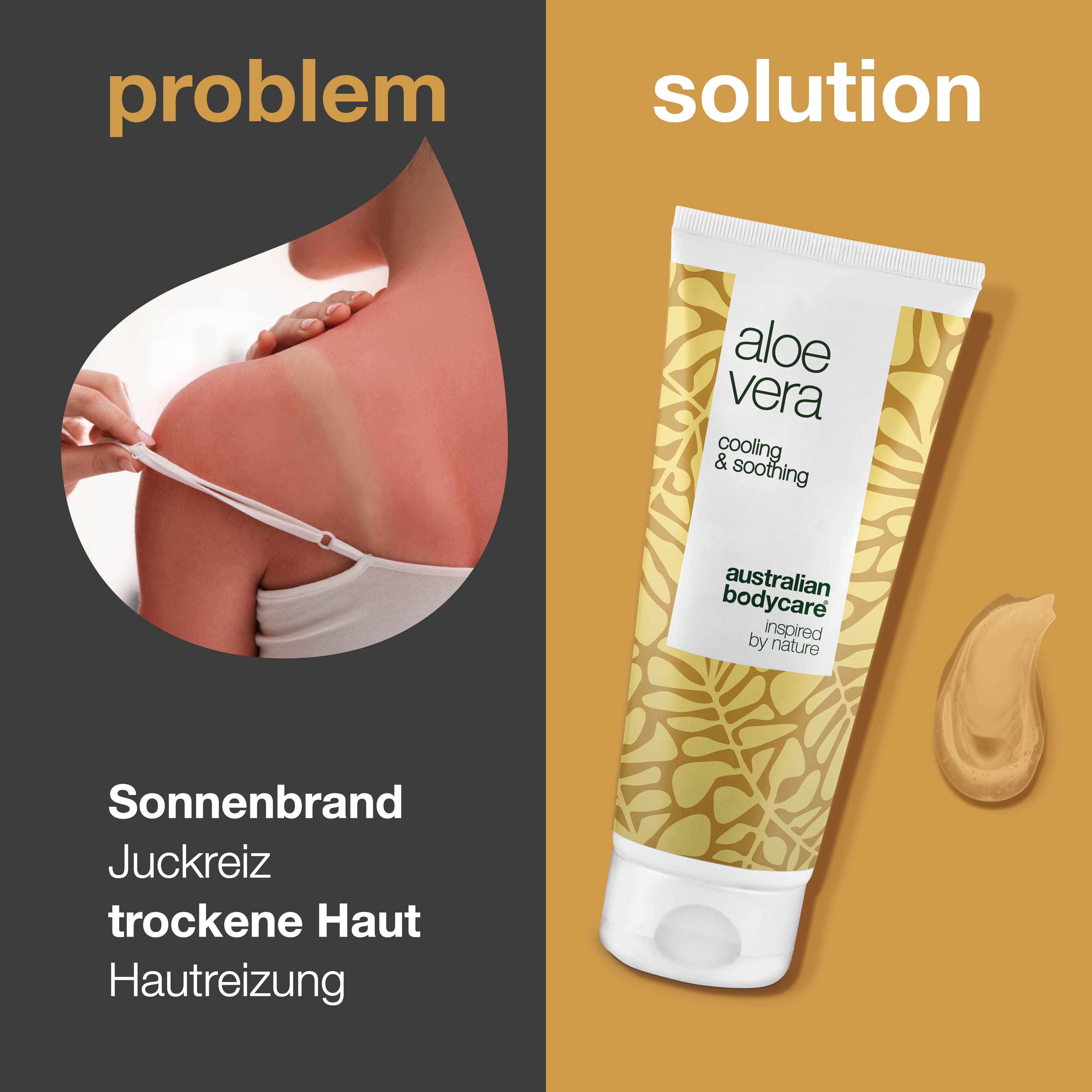 Aloe Vera Gel – Feuchtigkeitspflege für trockene und sonnenstrapazierte Haut
