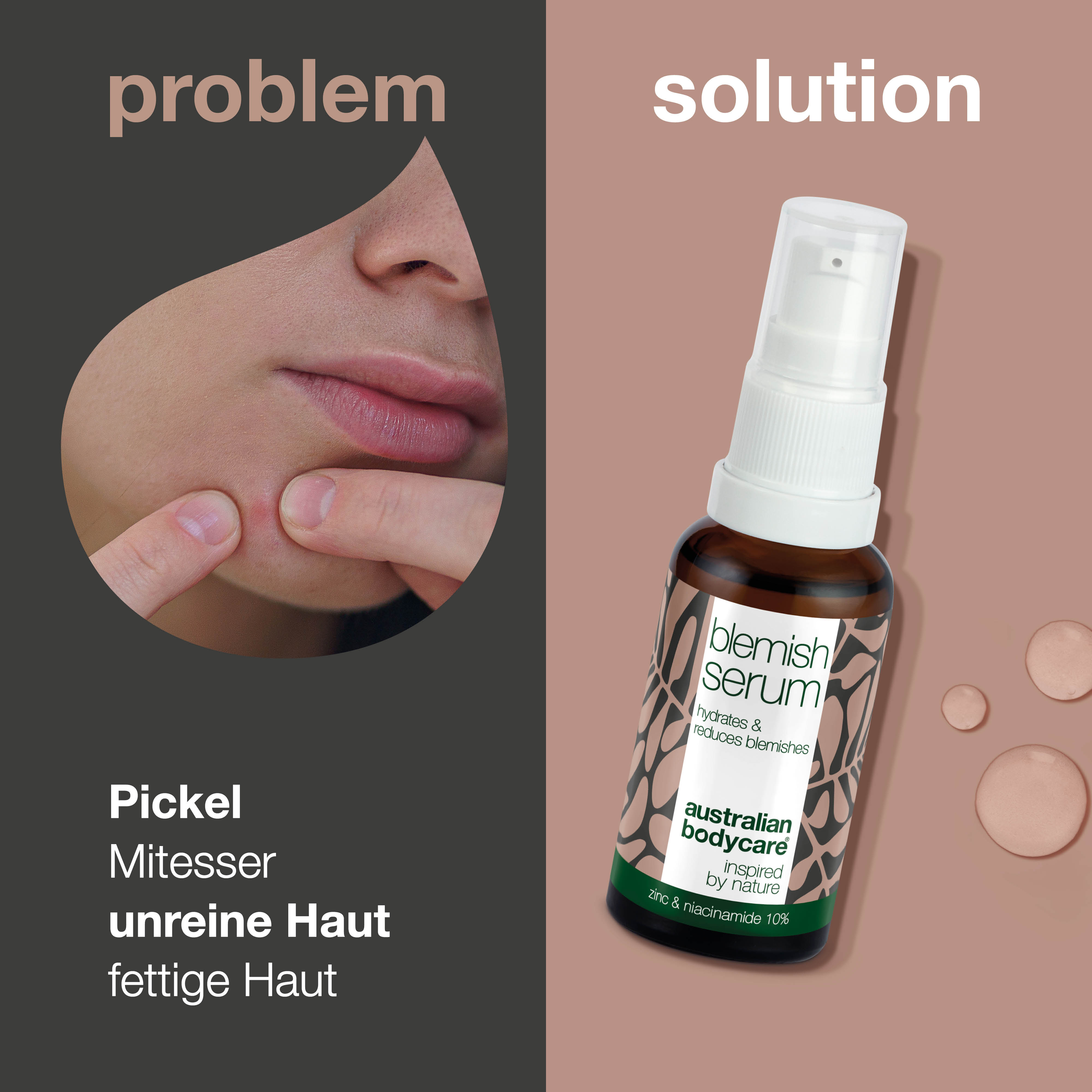 Anti Pickel Serum mit Niacinamiden — Gesichtsserum mit Niacinamiden 10%, Zink 1% und Teebaumöl bei Pickeln, Mitessern und unreiner Haut