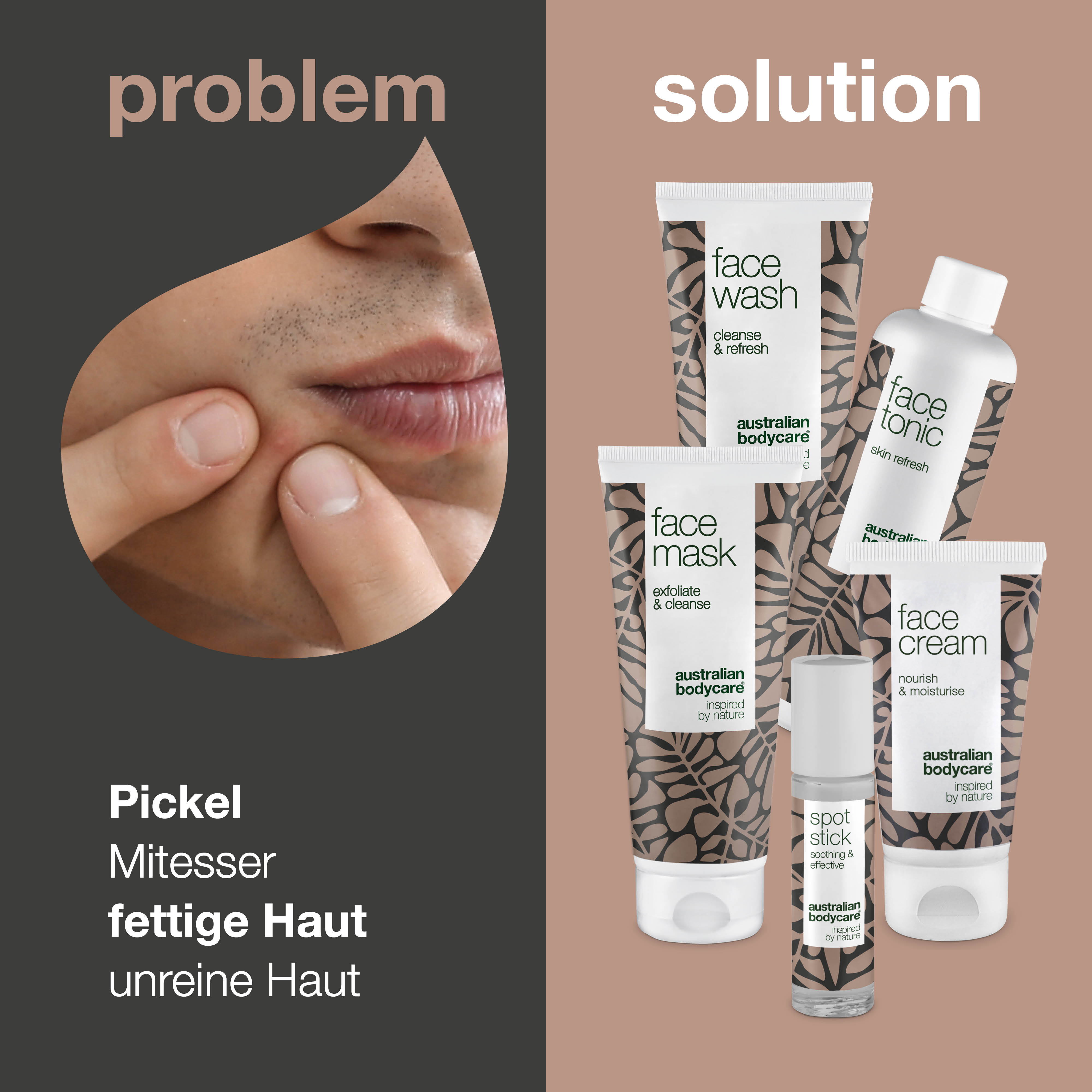 Das ultimative Gesichtspflege-Paket — 5 Produkte gegen Pickel, Mitesser und unreine Haut