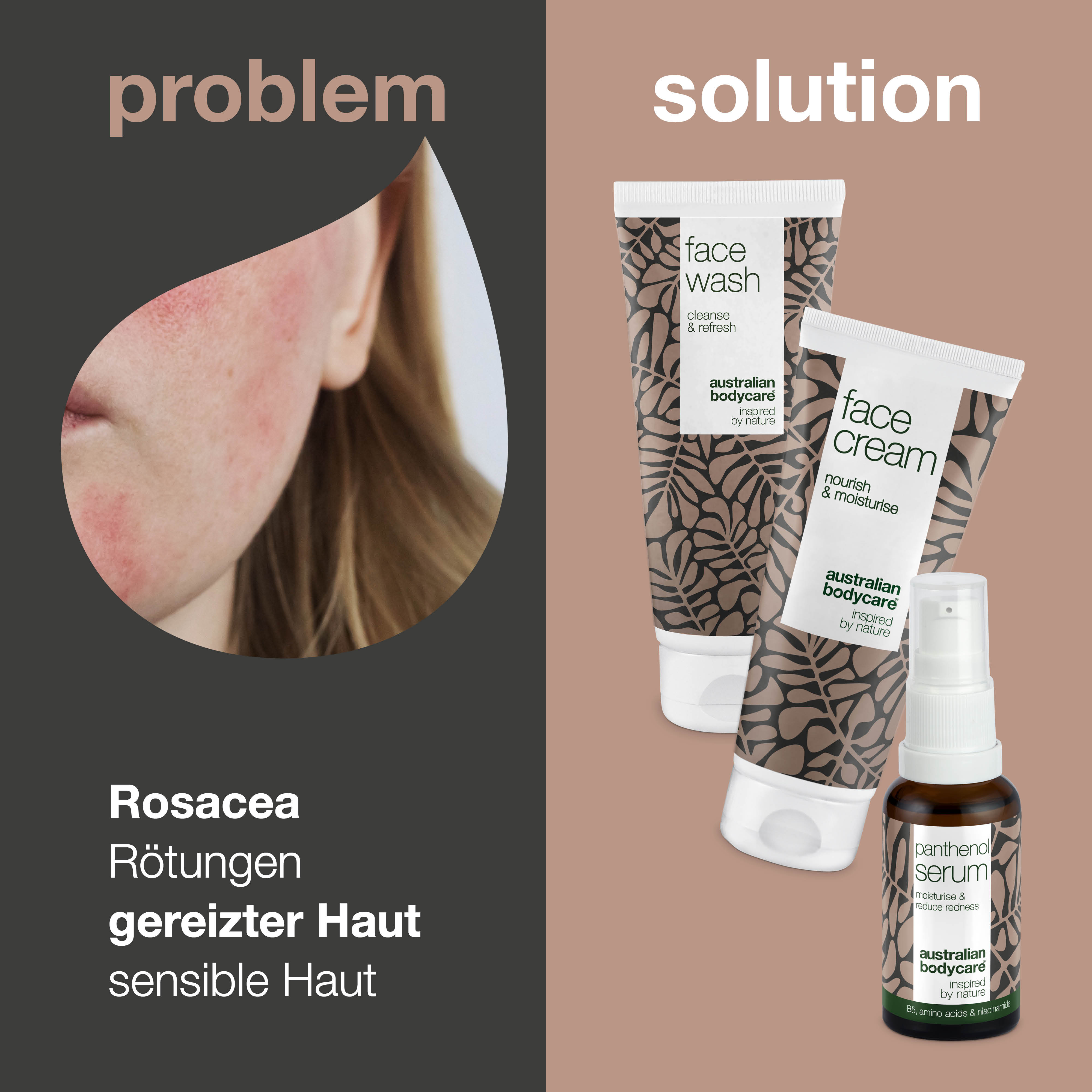 Set zur Pflege von Rosacea, Rötungen & gereizter Haut — 3 beruhigende Produkte zur Anwendung bei Rosacea; Reinigung, Vitamin B5 Serum & Creme
