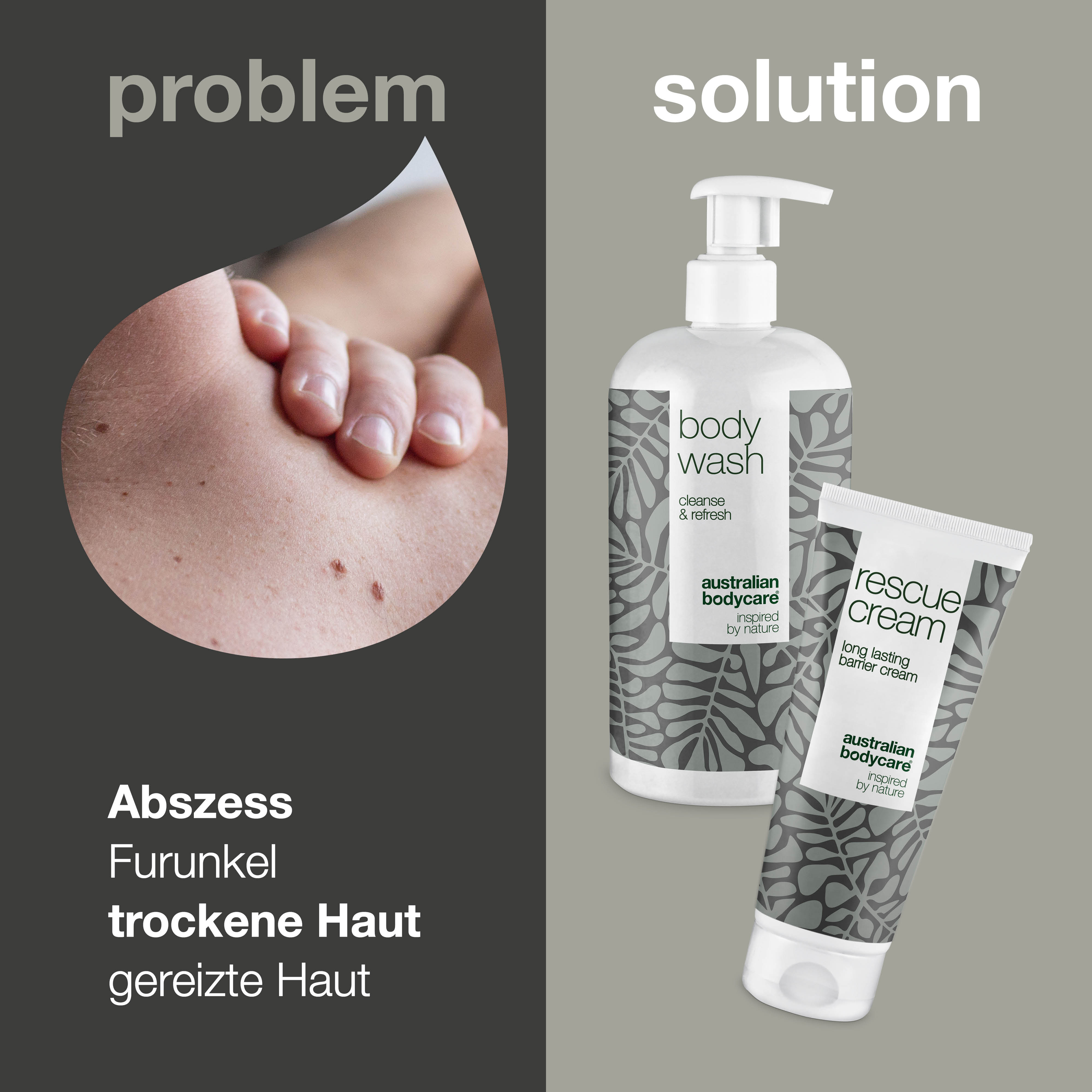 Paket zur Pflege bei Abszess — 2 Produkte zur täglichen Reinigung und Pflege bei Furunkel
