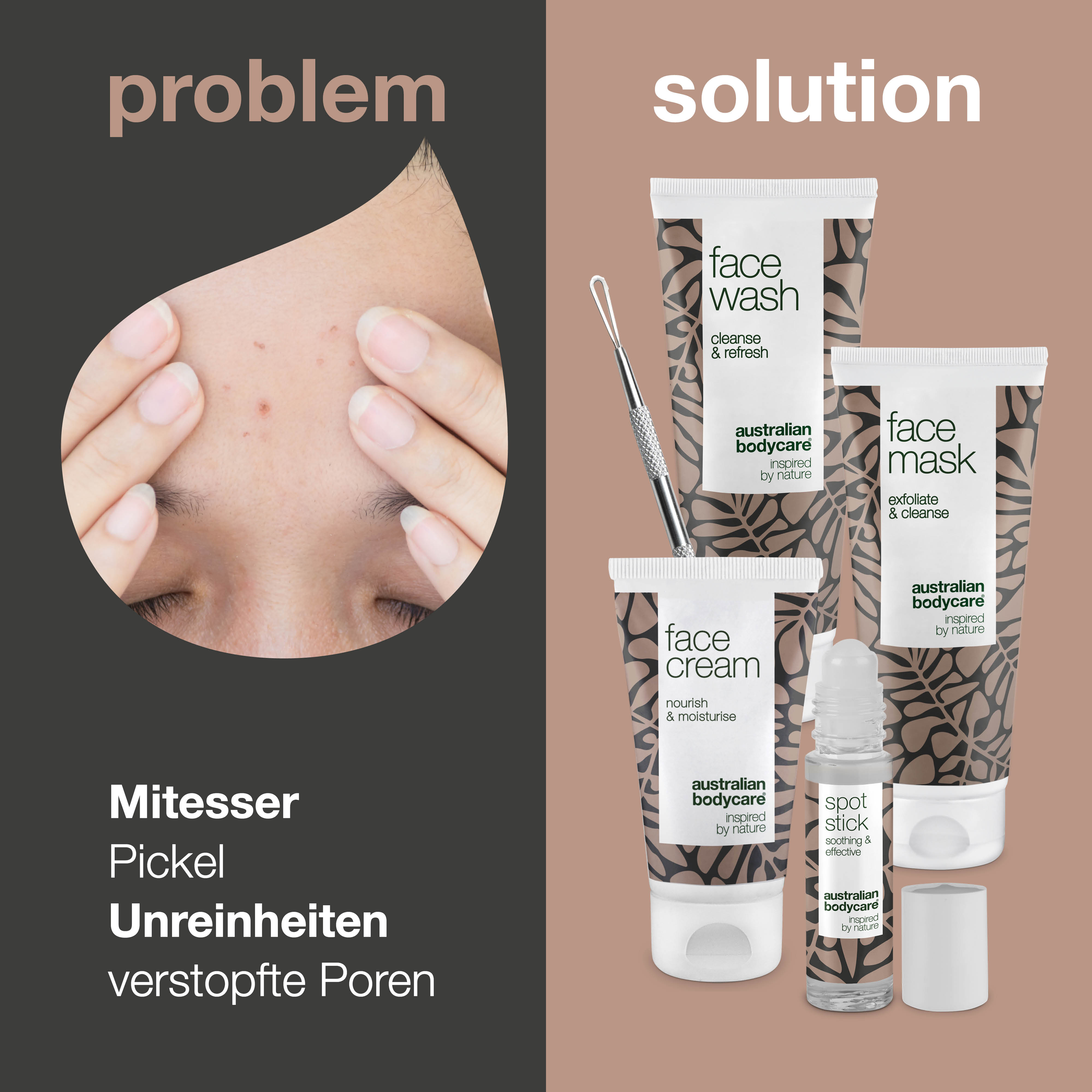 Mitesser entfernen - Set — 5x Produkte zur Entfernung von Mitessern auf der Nase und im Gesicht