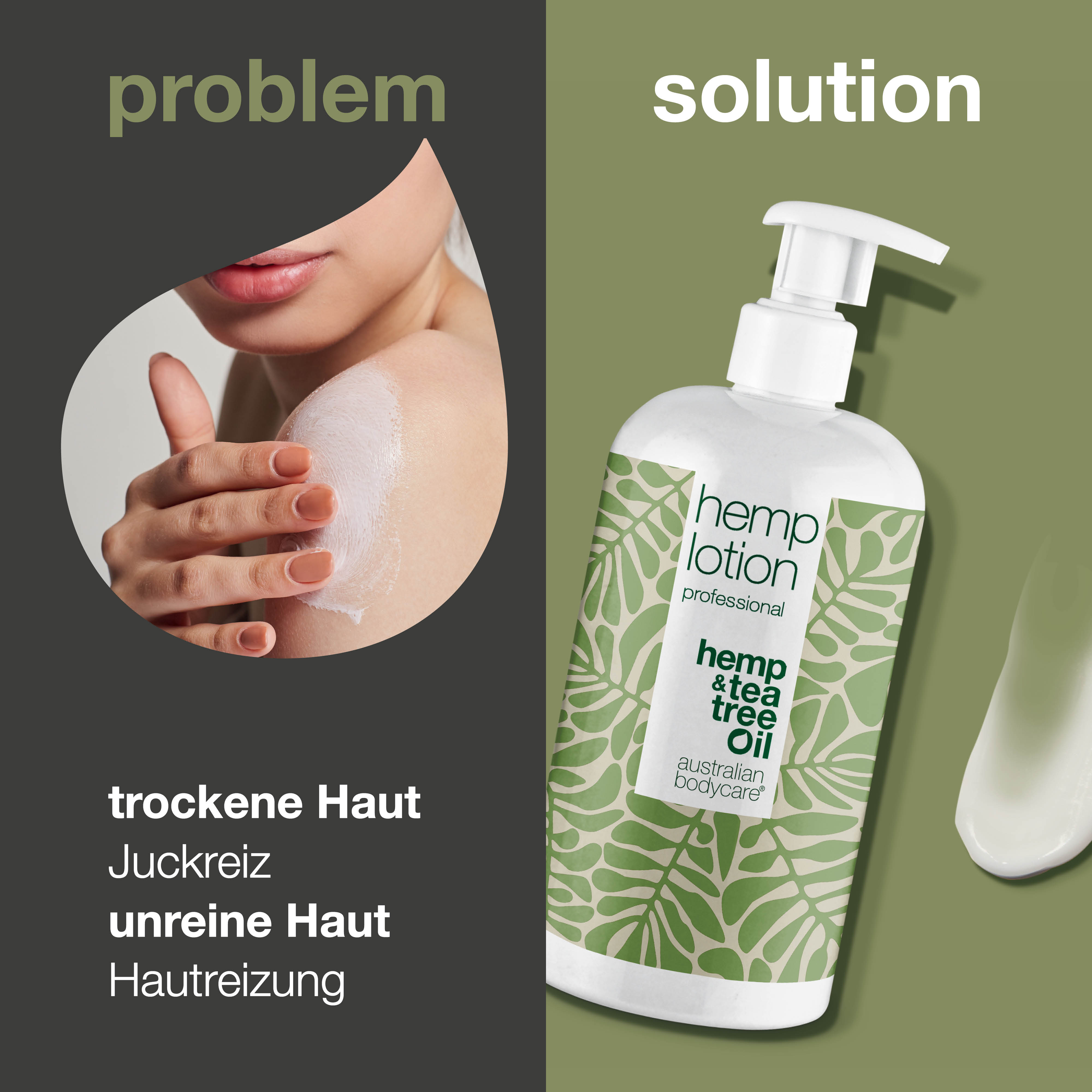 Hanf Body Lotion — Feuchtigkeitspflege für trockene Haut und Pickel am Körper