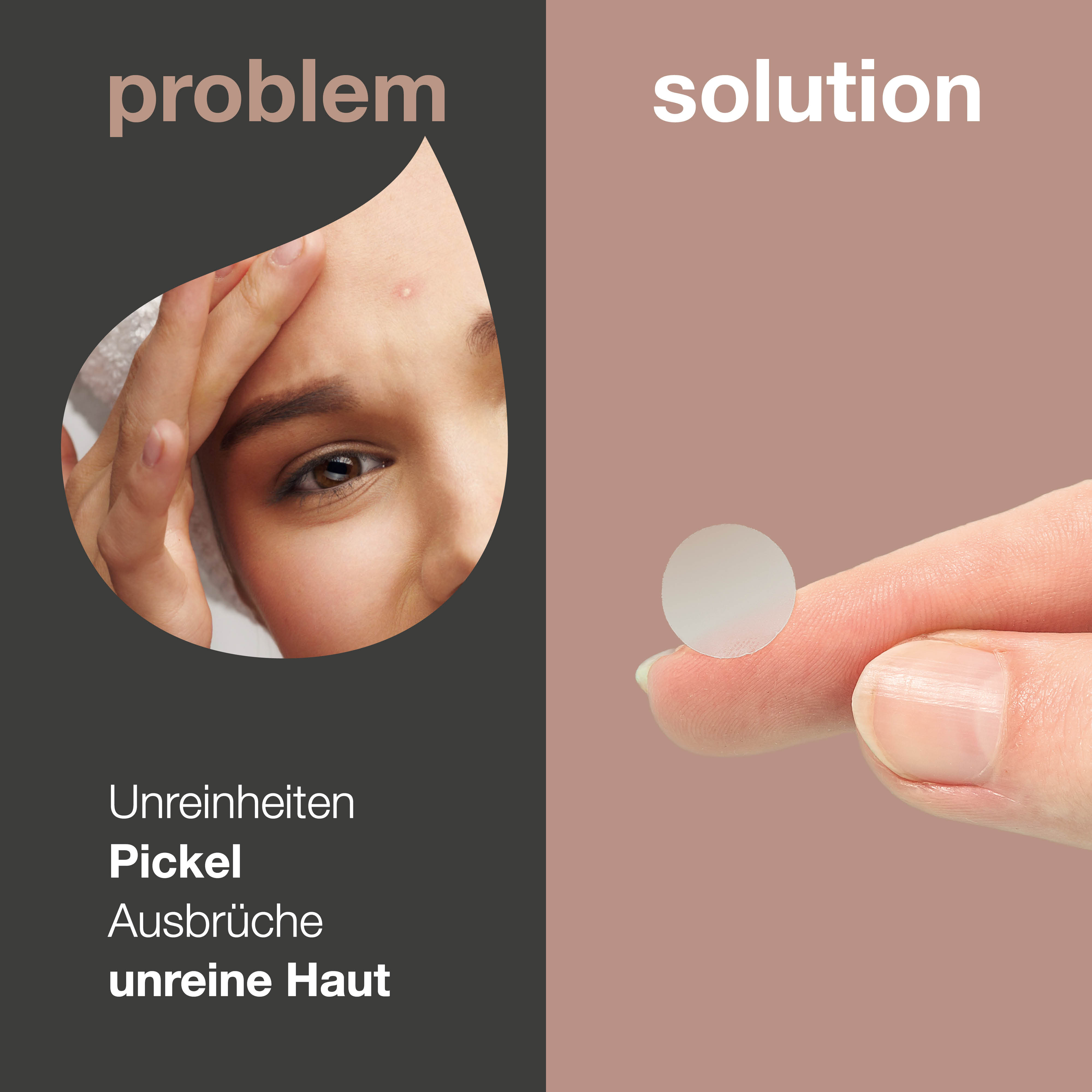 Pickel Patches mit Hyaluronsäure & Salicylsäure — Effektive Pimple Patches für reine Haut