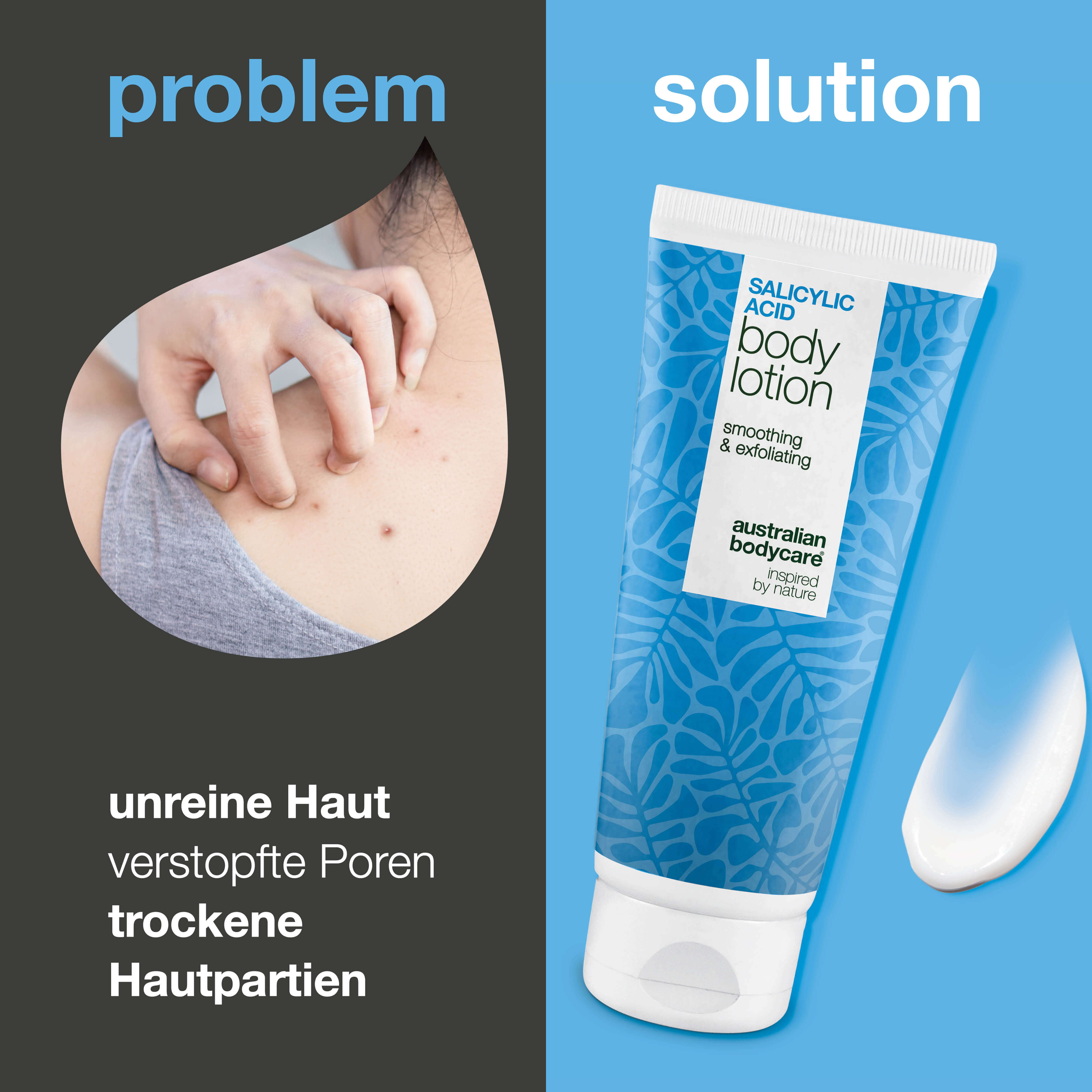 Keratosis Pilaris Body Lotion glättet raue, trockene Haut und Unebenheiten. Ideal bei Reibeisenhaut. Mit Salicylsäure, Niacinamid und Zink PCA.
