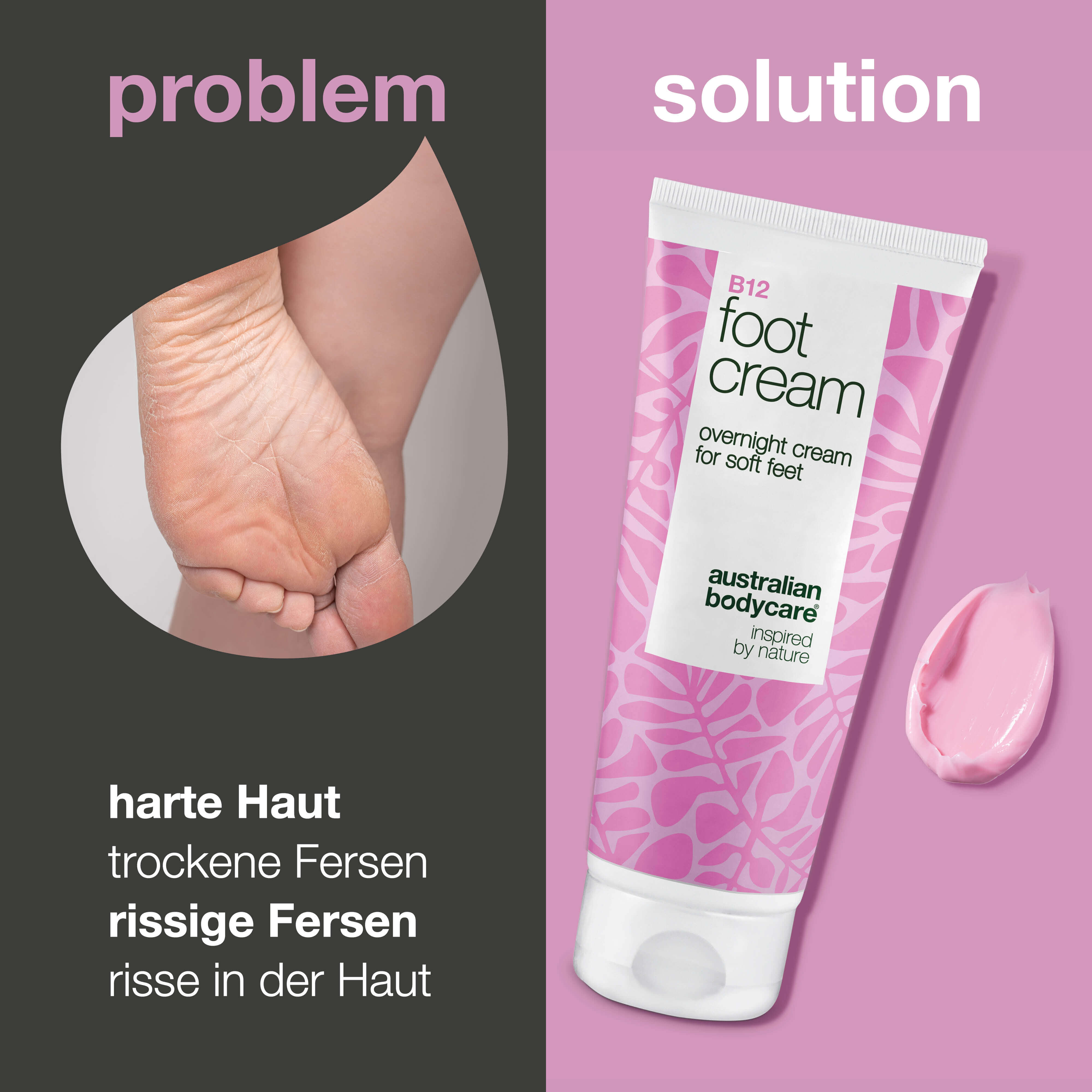 Fußcreme mit Vitamin B12 – pflegt & spendet Feuchtigkeit — Fußcreme mit Vitamin B12 und 10 % Urea für trockene Füße. Spendet Feuchtigkeit und macht die Haut weich. Perfekt für Tag und Nacht.