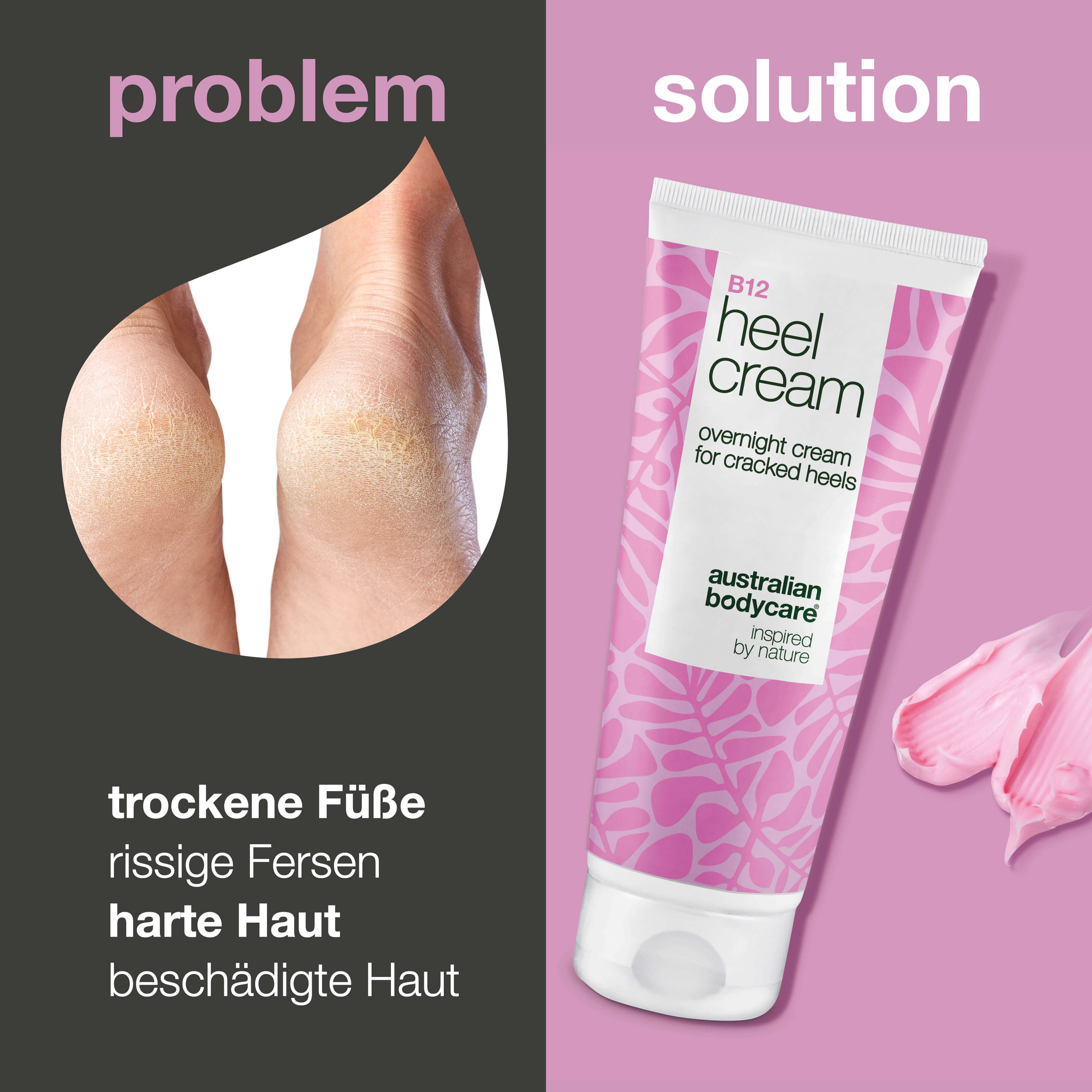 Intensive Fersenpflege mit 25 % Urea & Vitamin B12 — Sag trockenen Fersen ade! Diese Creme mit 25 % Urea & Vitamin B12 versorgt die Haut intensiv mit Feuchtigkeit und Pflege.
