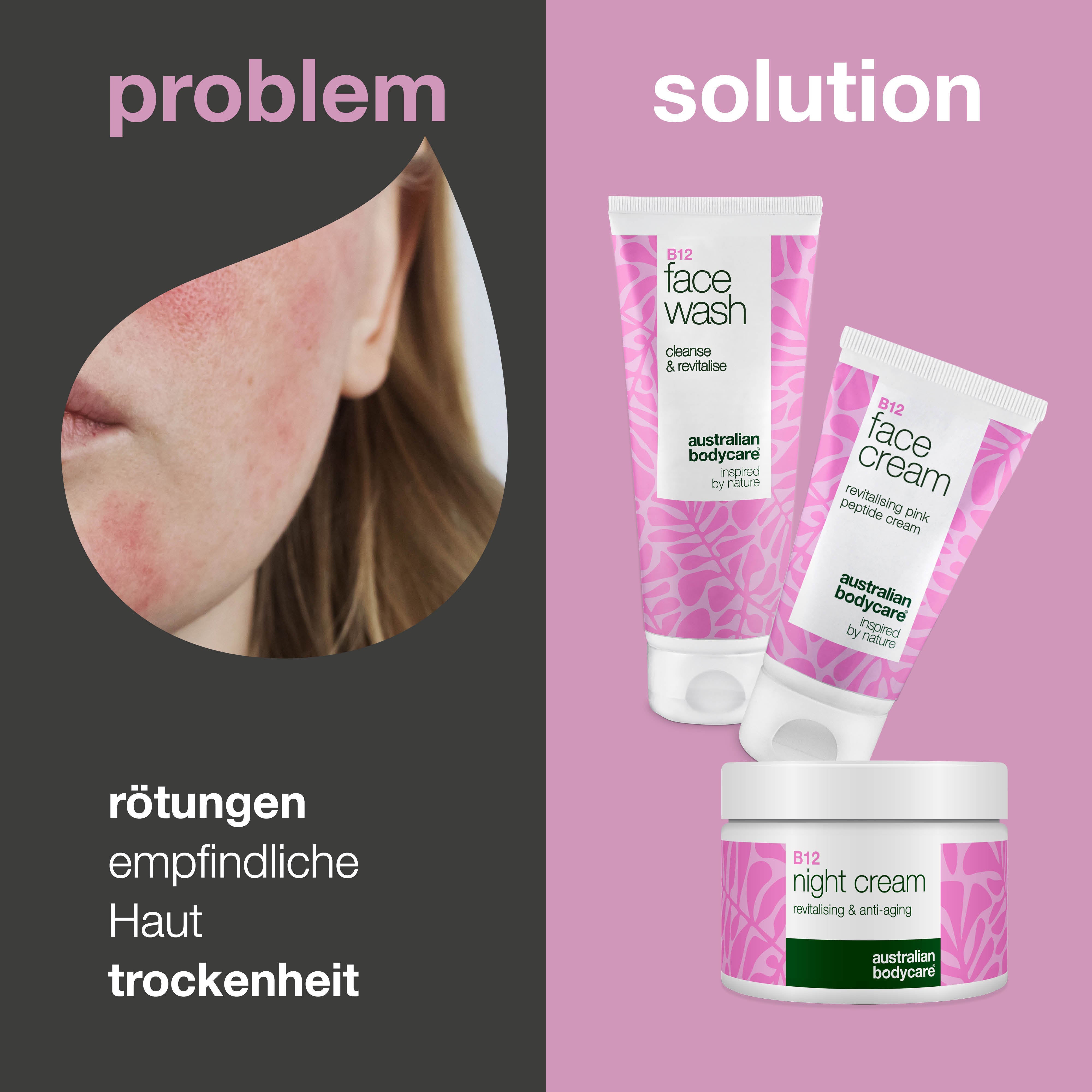 B12 Hautpflegeset gegen Rötungen – Reiniger und Cremes — B12 Pflege gegen Rötungen und Rosazea. Mit Gesichtsreiniger, Tages- und Nachtcreme, die beruhigen und hydratisieren.
