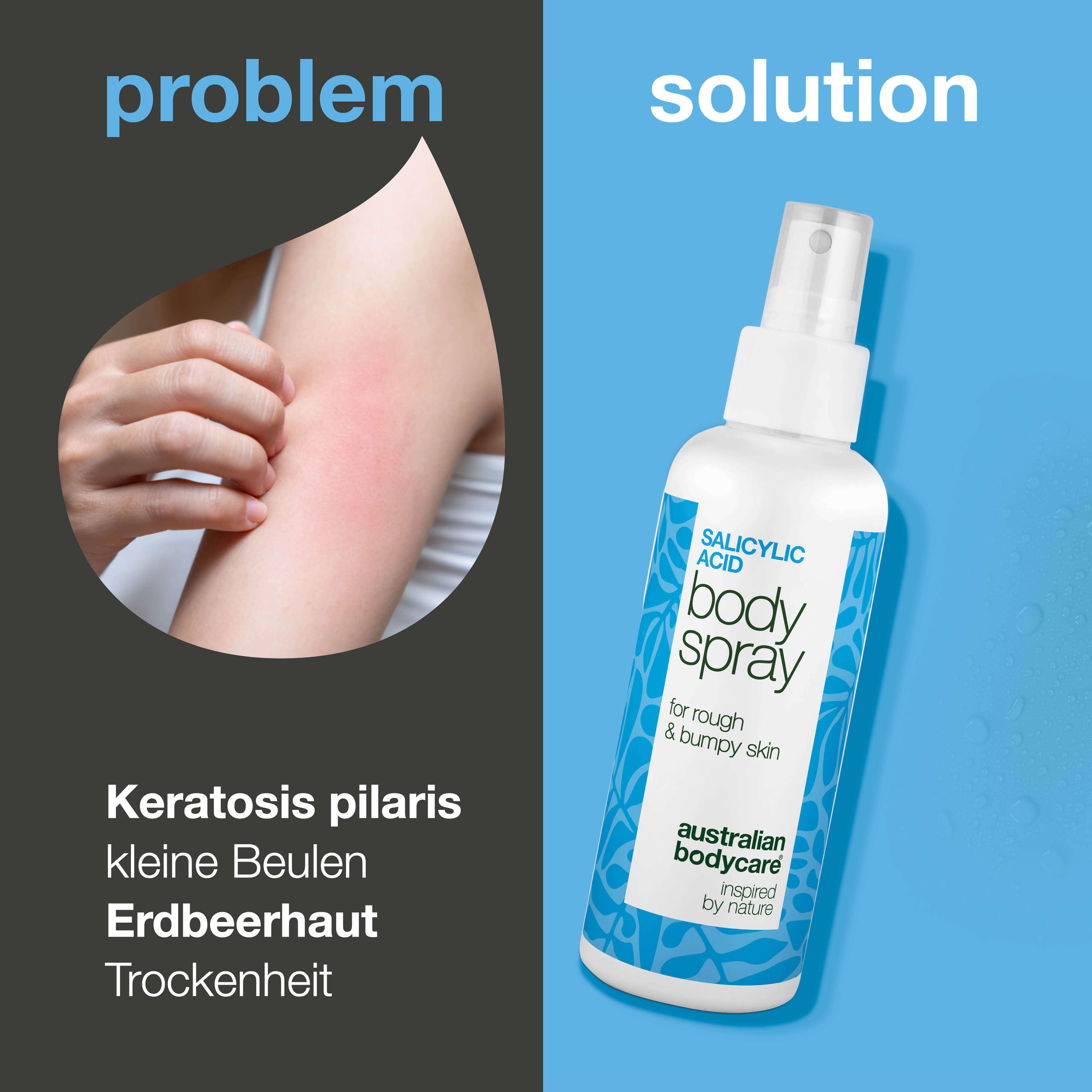 Spray bei Keratosis Pilaris und Reibeisenhaut an Armen und Beinen — Keratosis Pilaris Spray glättet raue Haut und Pickelchen. Mit Salicylsäure zur sanften, tiefenwirksamen Exfoliation.