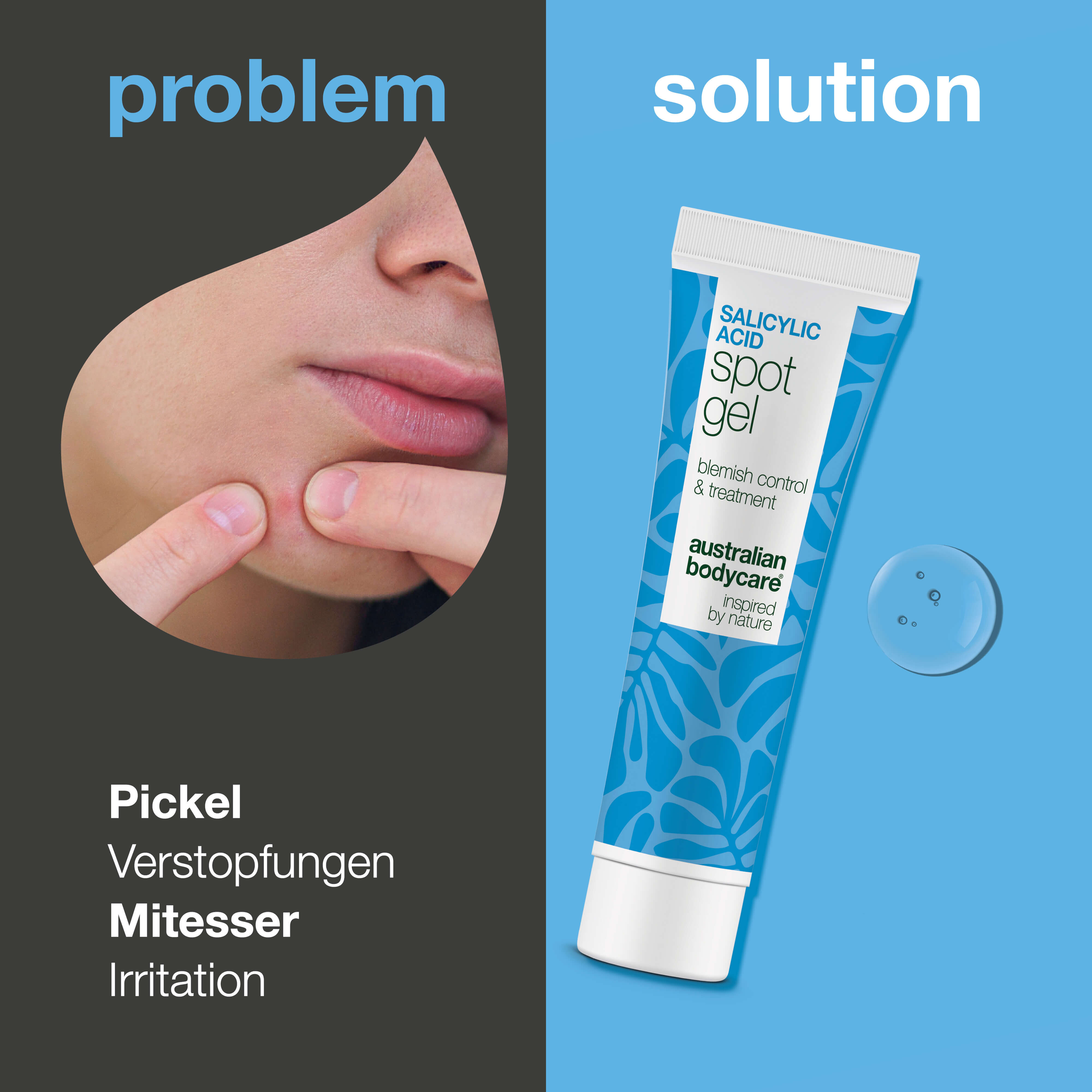 Salicylsäure Spot Gel gegen Pickel und verstopfte Poren — Salicylsäure Spot Gel klärt fettige Haut und entfernt Talg. Effektive Pflege mit Salicylsäure für reine, glatte Haut.