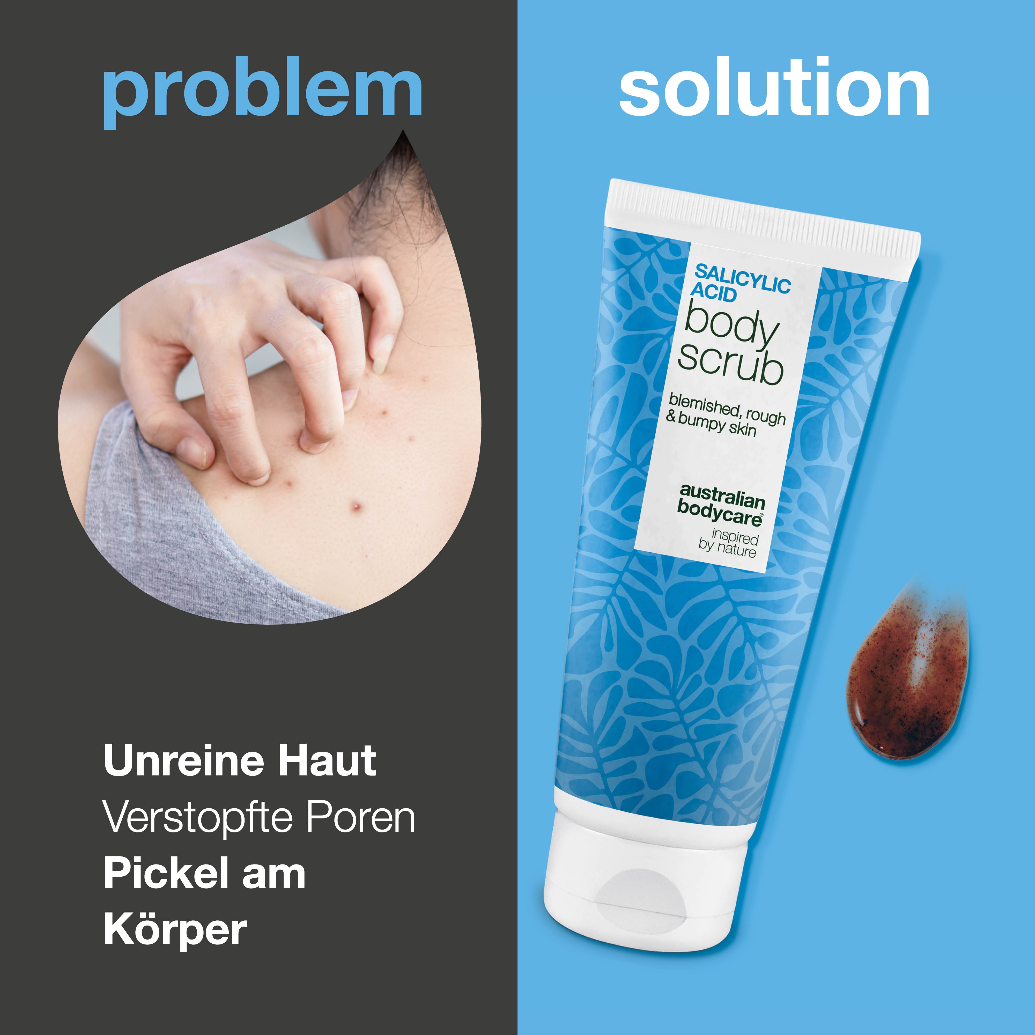 Body Scrub mit Salicylsäure gegen Pickel und verstopfte Poren — Body Scrub mit Salicylsäure reinigt Poren und entfernt Pickel. Mit Salicylsäure, Glykolsäure, Aprikosenkernpulver und Allantoin.