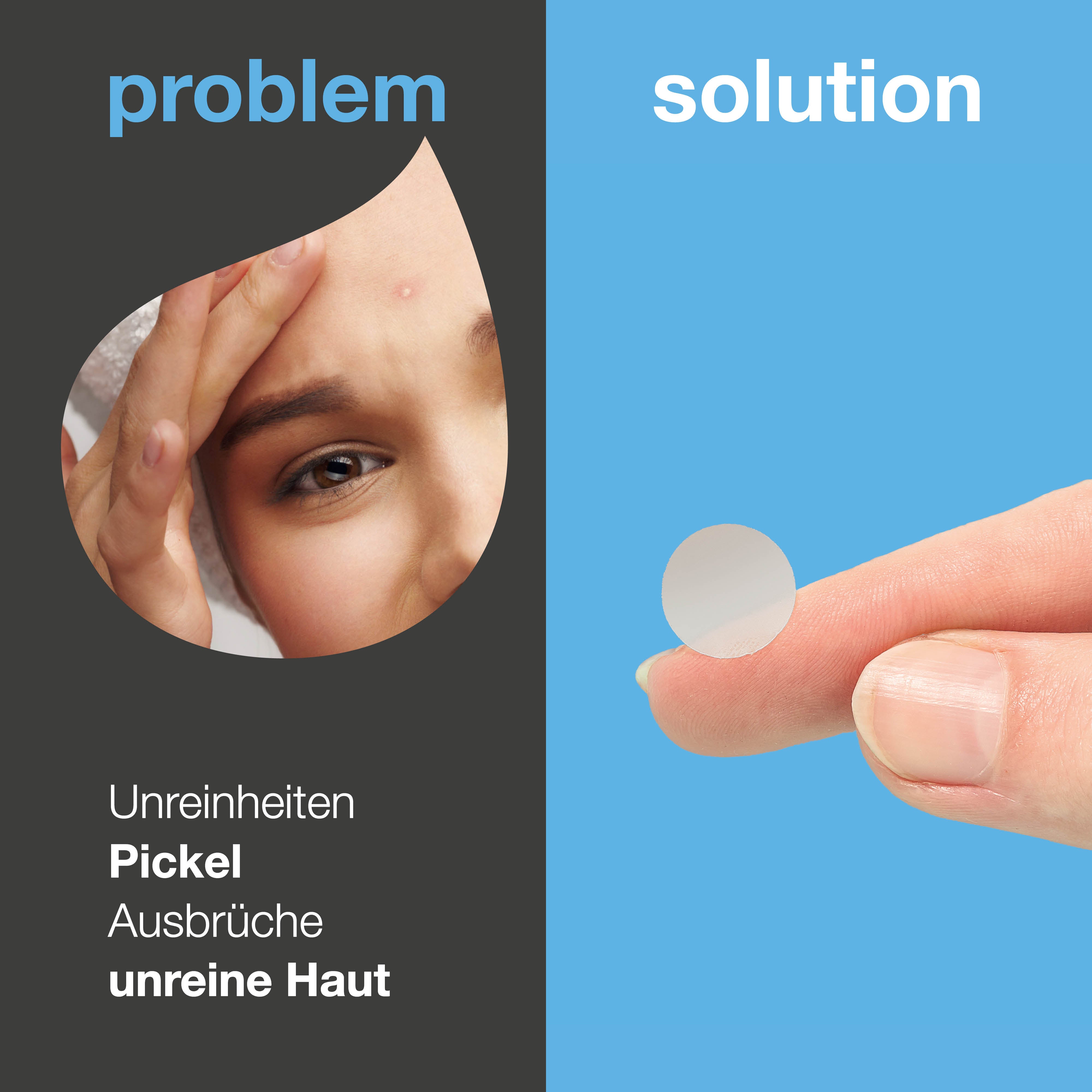Salicylsäure Pimple Patches helfen bei unreiner, fettiger Haut und verstopften Poren. Enthält Salicylsäure, grüner Tee und Hyaluronsäure.