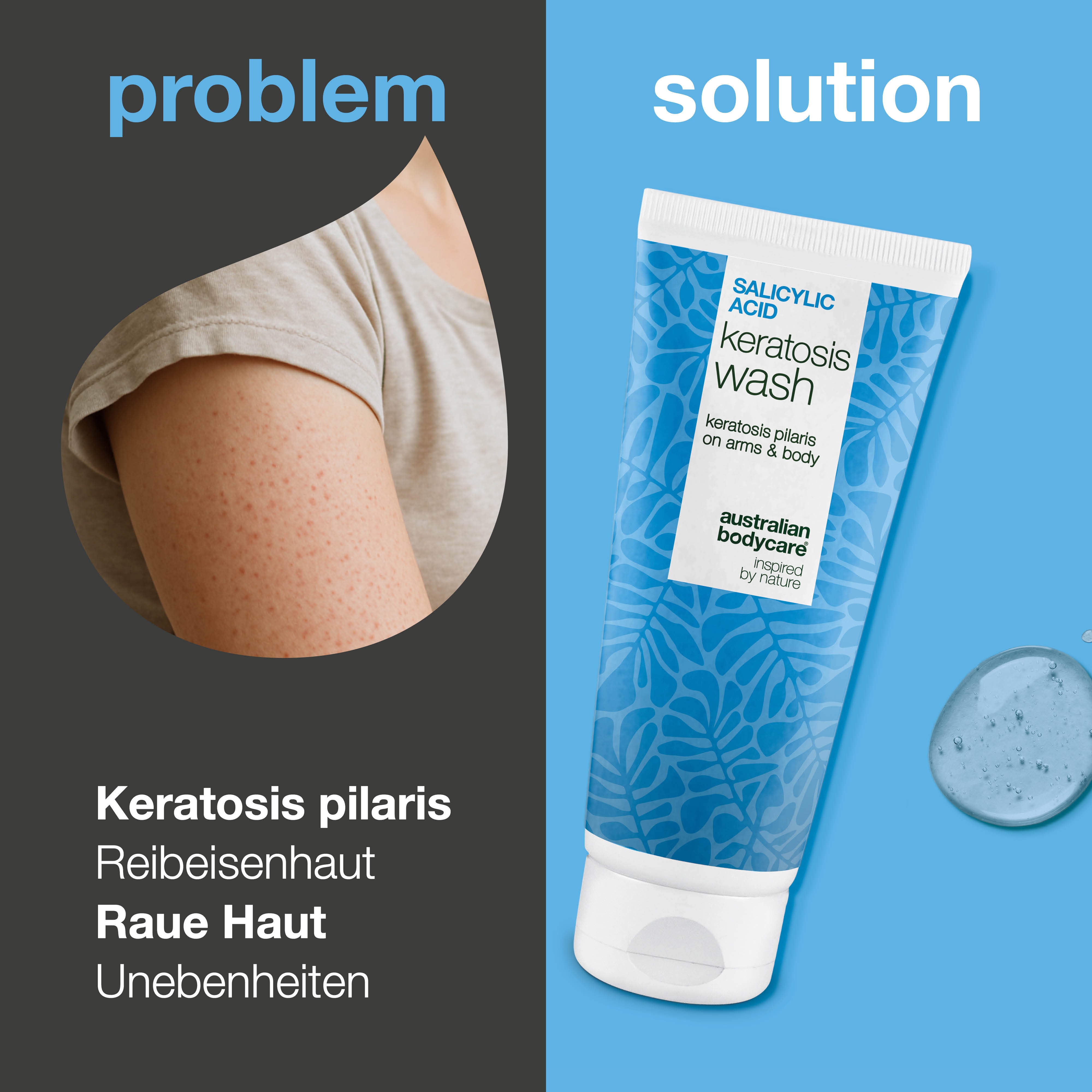 Keratosis Pilaris Body Wash gegen Keratosis Pilaris, trockene Haut und verstopfte Poren. Enthält Salicylsäure, Niacinamid, Zink PCA und Vitamin E.