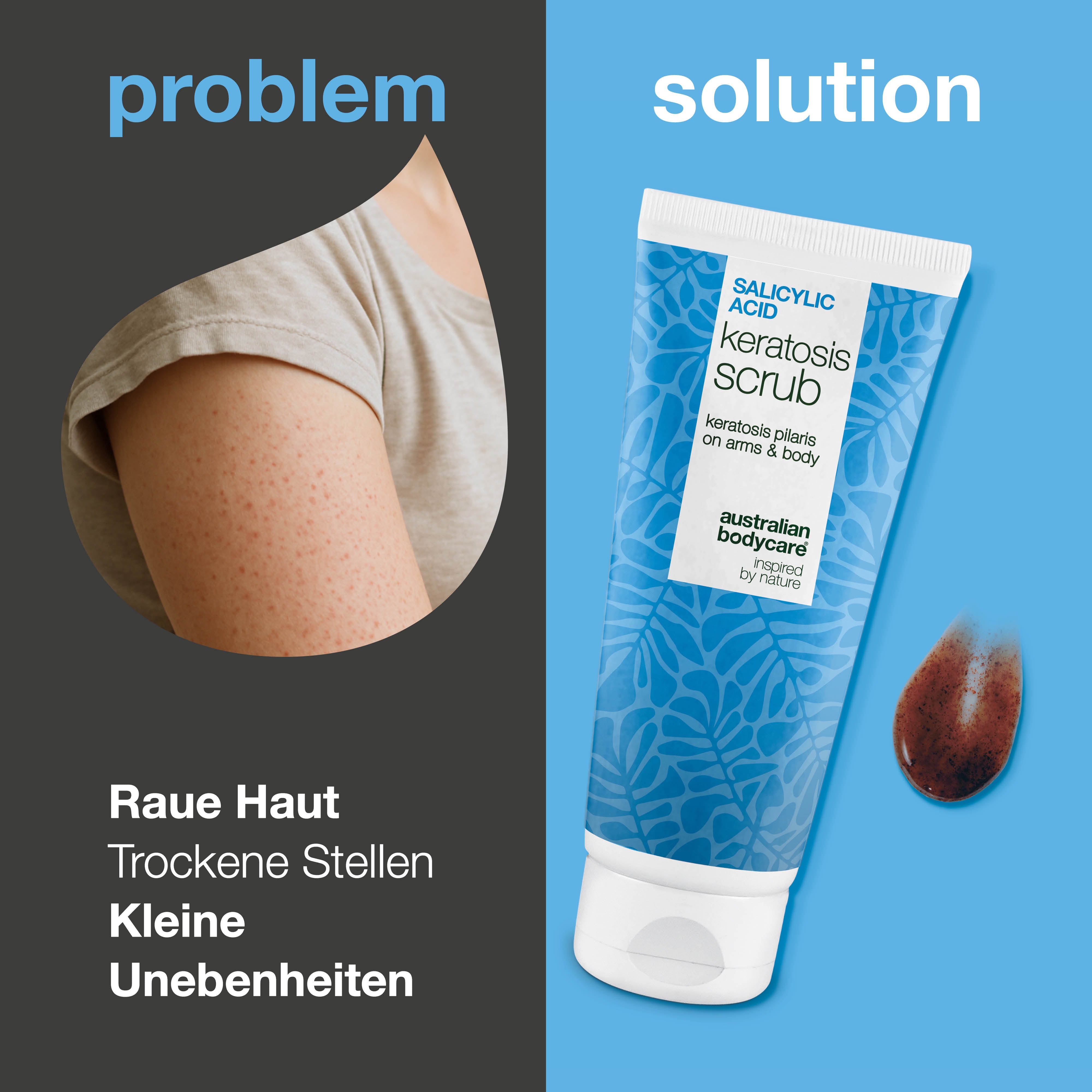 Keratosis-Pilaris Körperpeeling entfernt abgestorbene Zellen und reduziert Unebenheiten. Mit Salicylsäure, Glykolsäure, Allantoin und Glycerin für glatte Haut.