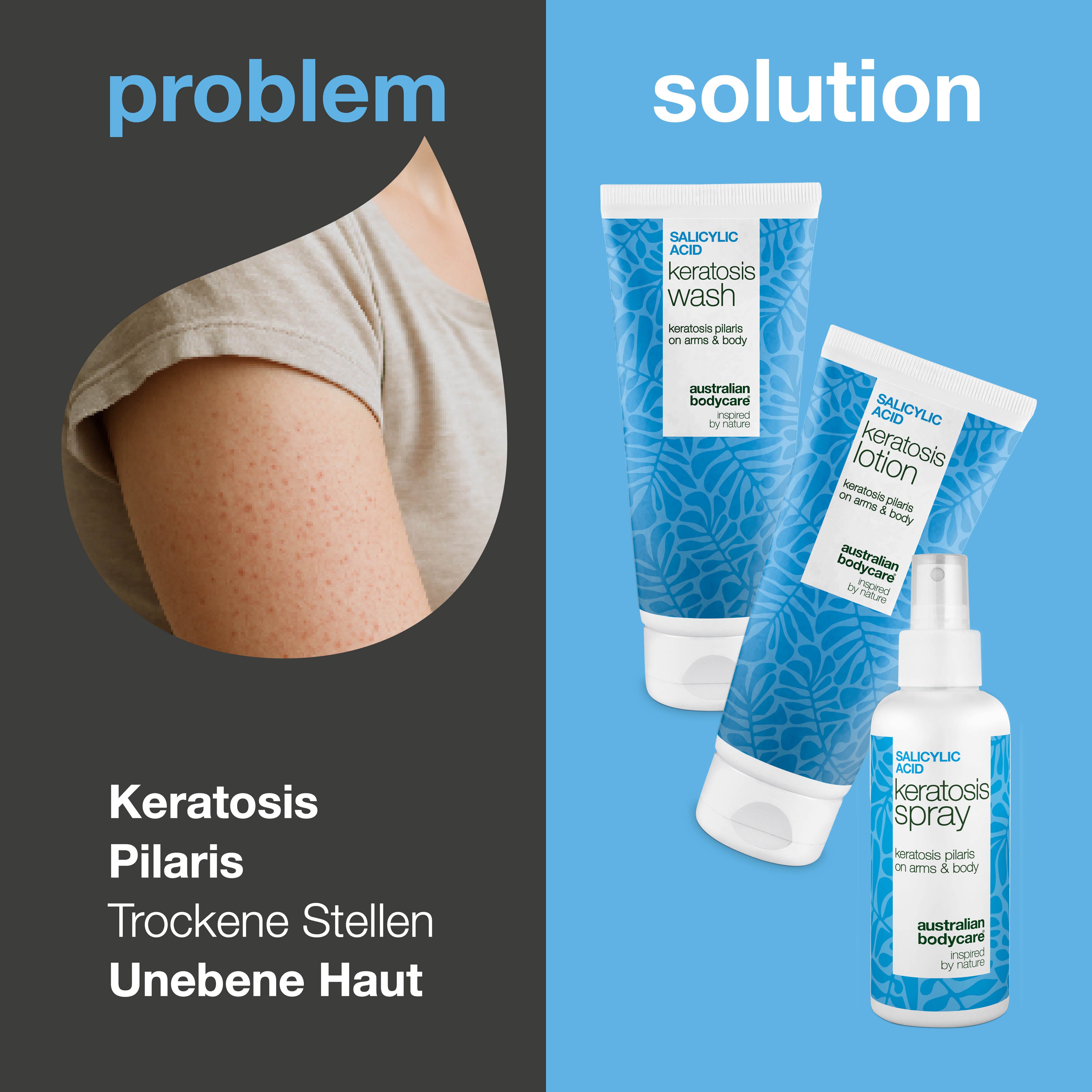 3er Körperset gegen Keratosis Pilaris – Glättet raue Haut — Pflegeset bei Reibeisenhaut/Erdbeerhaut reduziert raue, unebene Haut. Macht Arme, Beine (Erdbeerbeine) und Po spürbar glatt und weich.