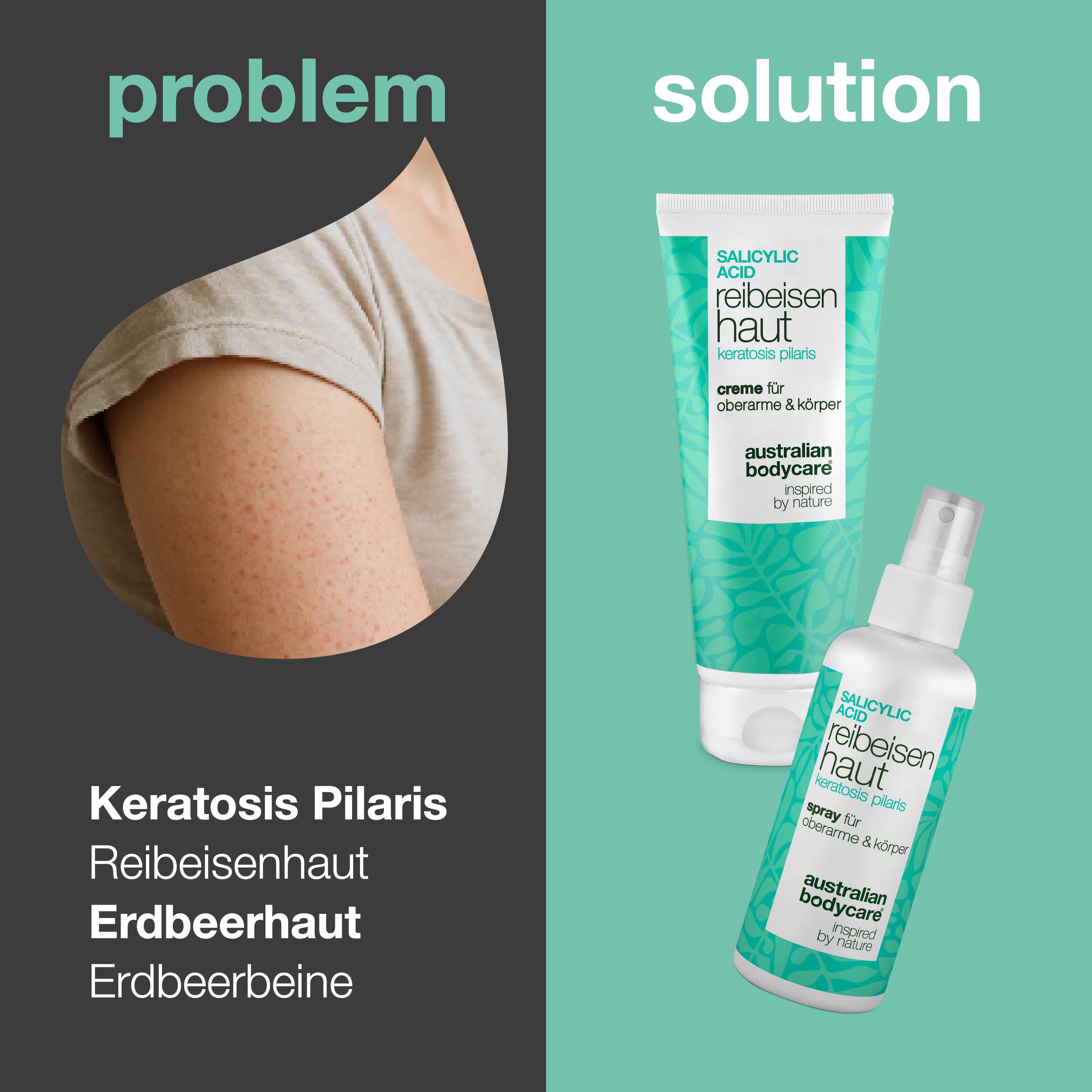 Reibeisenhaut Spray und Creme für Keratosis Pilaris, Reibeisenhaut und Erdbeerhaut für glatter wirkende Haut