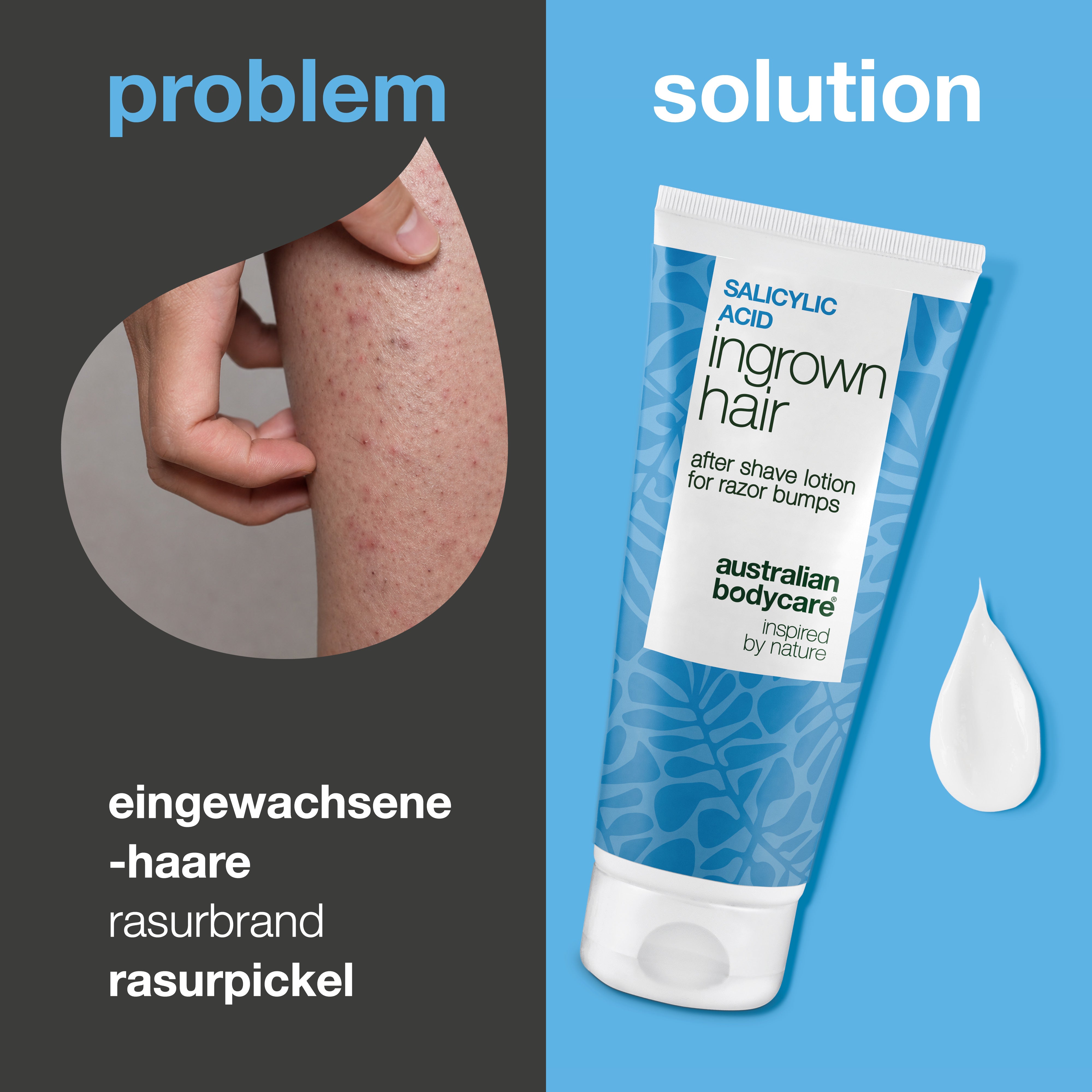 Salicylsäure After Shave Lotion gegen eingewachsene Haare, Rasierpickel und Hautirritationen nach der Rasur. Das Produkt wird neben Haut mit sichtbaren Rasierpickeln und eingewachsenen Haaren gezeigt.