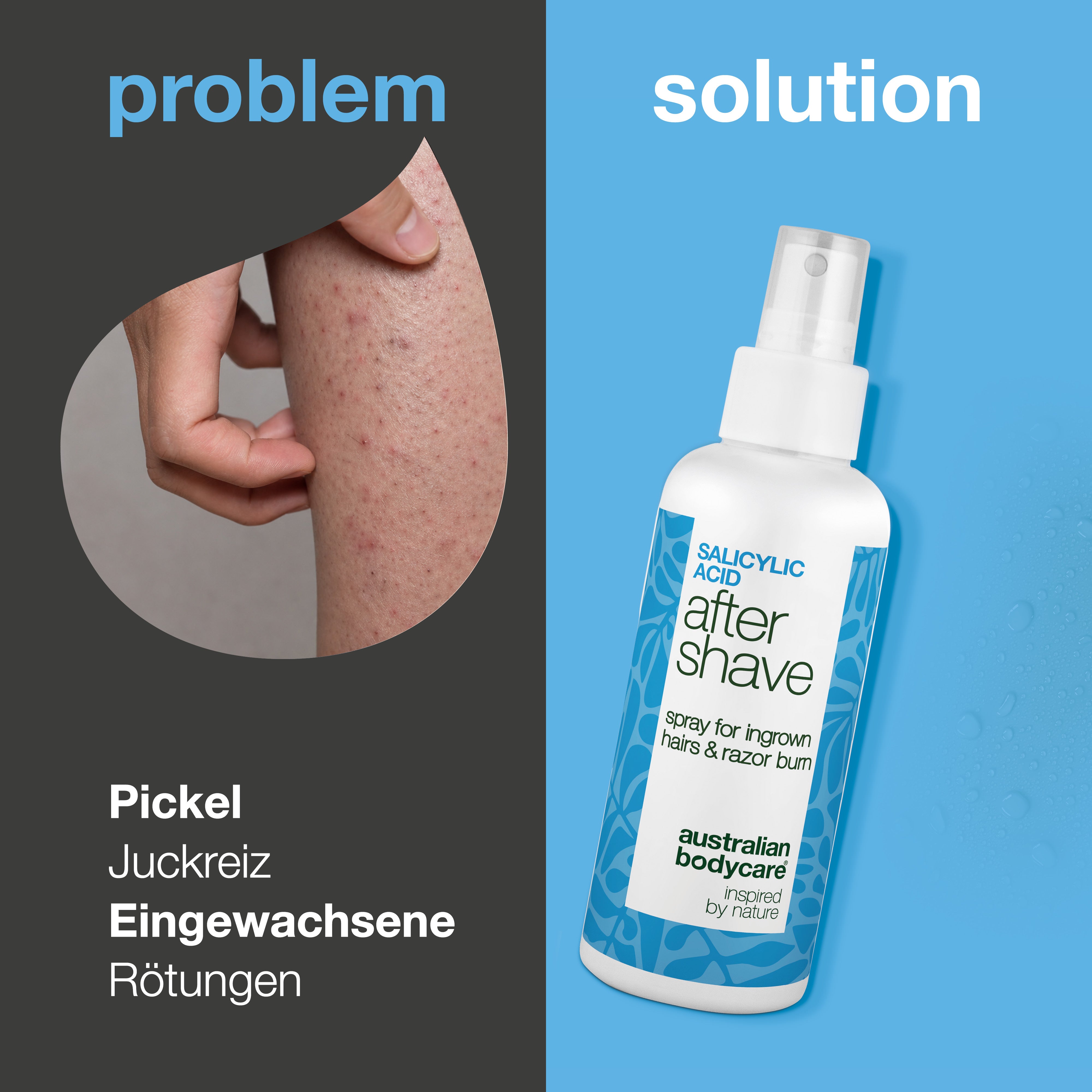 Salicylsäure After Shave Spray gegen Rasierpickel — After Shave Spray gegen Rasurbrand und eingewachsene Haare. Beruhigt Juckreiz mit Salicylsäure und Aloe Vera. Für glatte Haut.