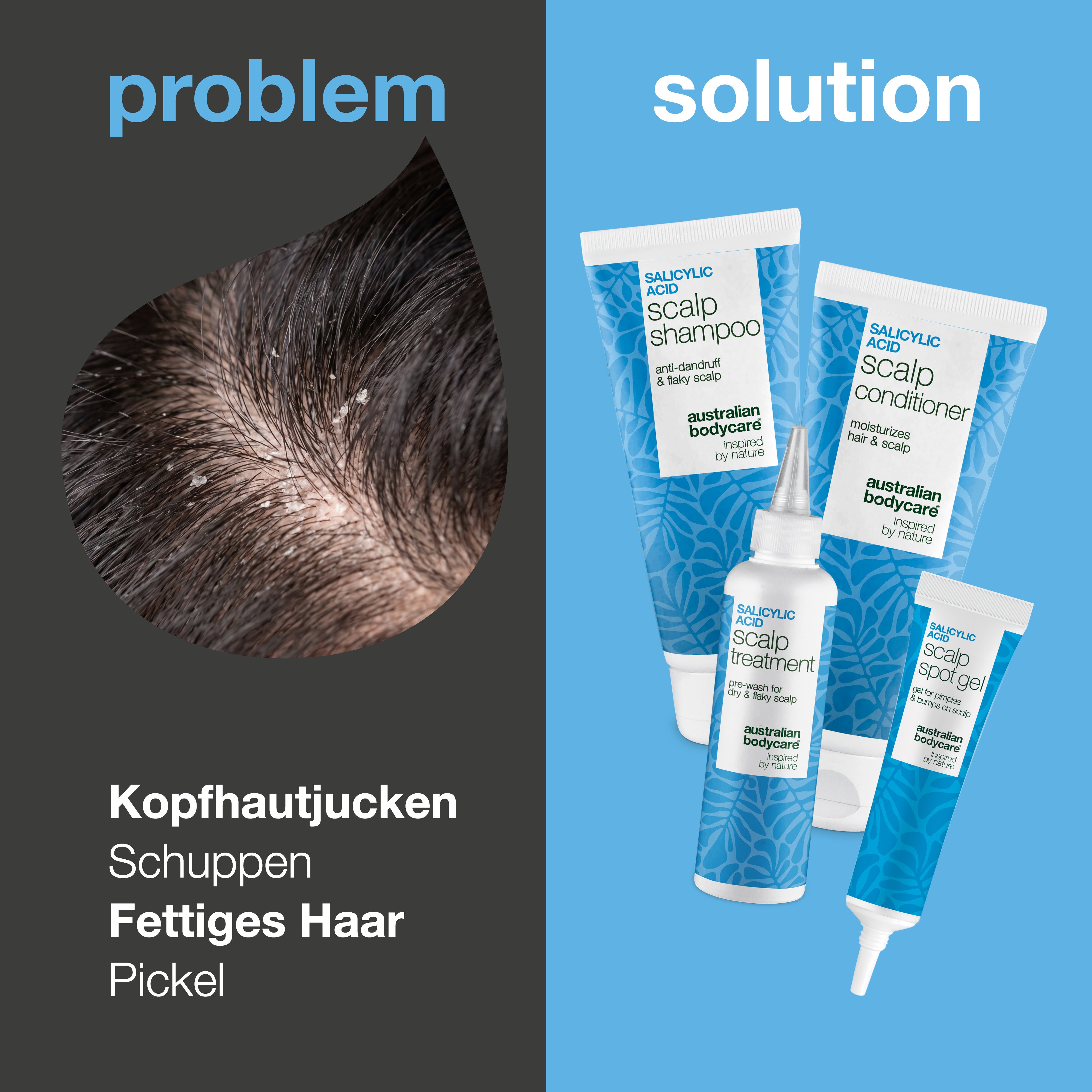 Problem und Lösung: Nahaufnahme von Schuppen auf der Kopfhaut neben den vier Produkten gegen Juckreiz, Schuppen und Pickel