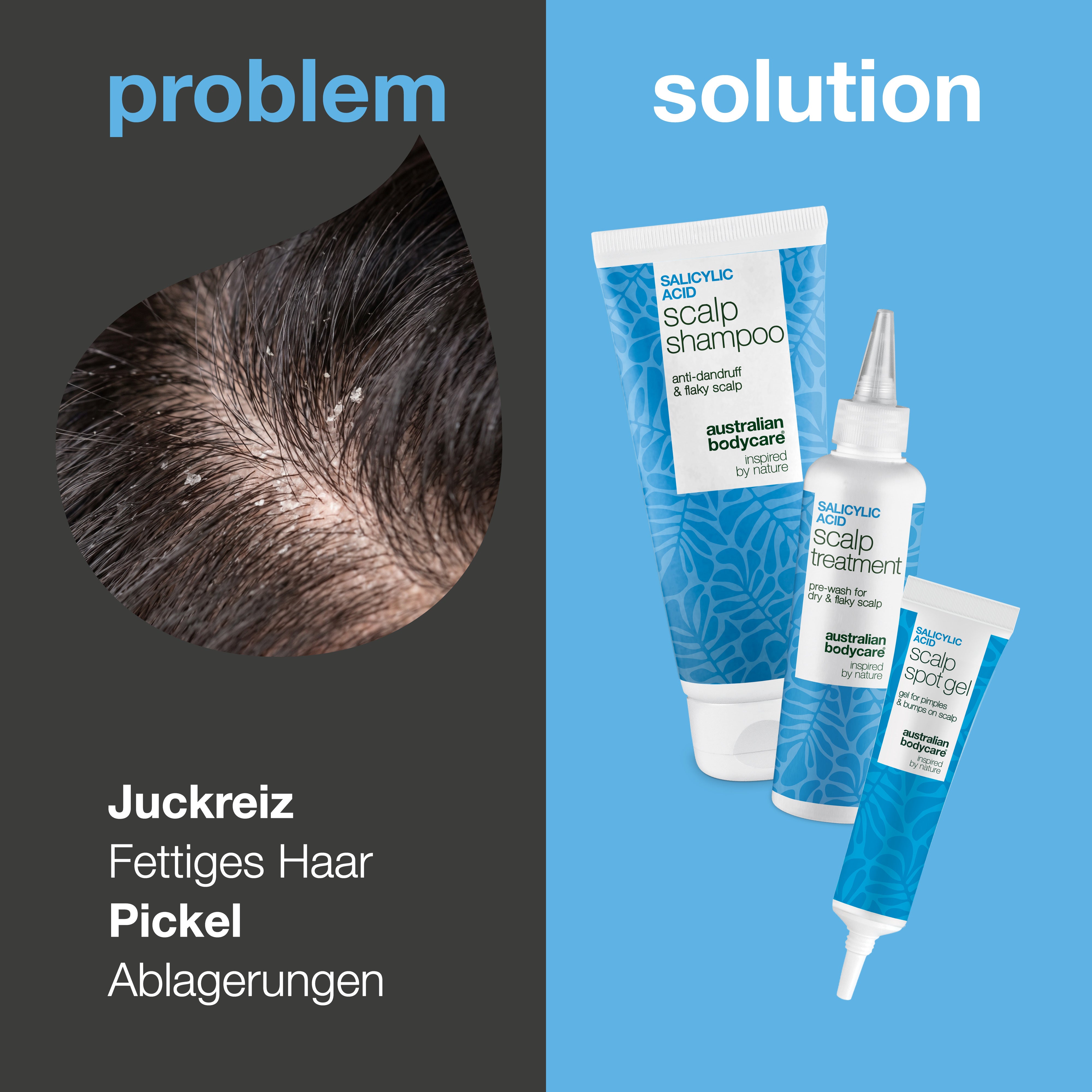 Problem und Lösung: Nahaufnahme von Juckreiz, fettigem Haar und Ablagerungen neben den drei Produkten des Sets