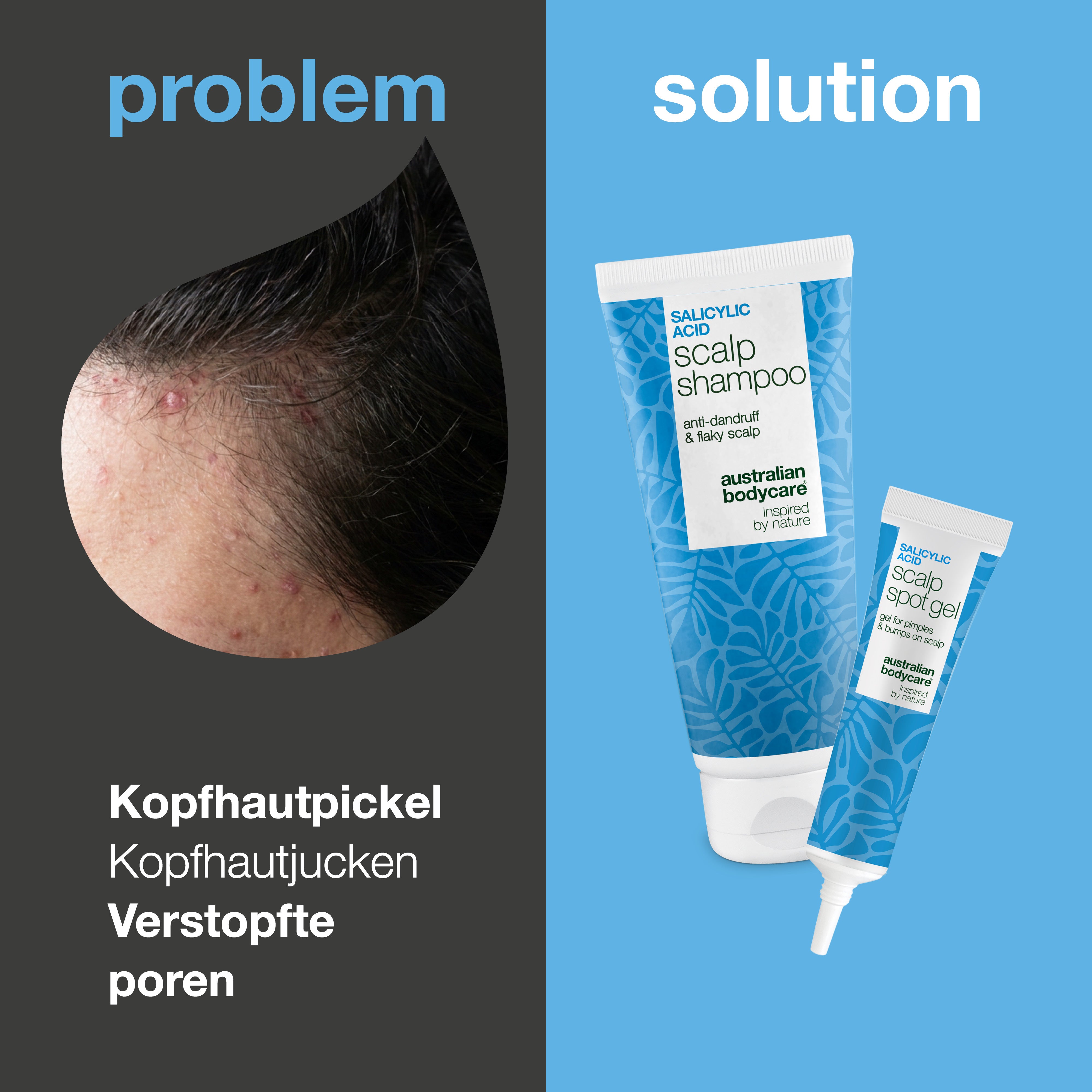 Problem und Lösung: Nahaufnahme von Pickeln und Knötchen auf der Kopfhaut neben Shampoo und Spot Gel aus dem Set