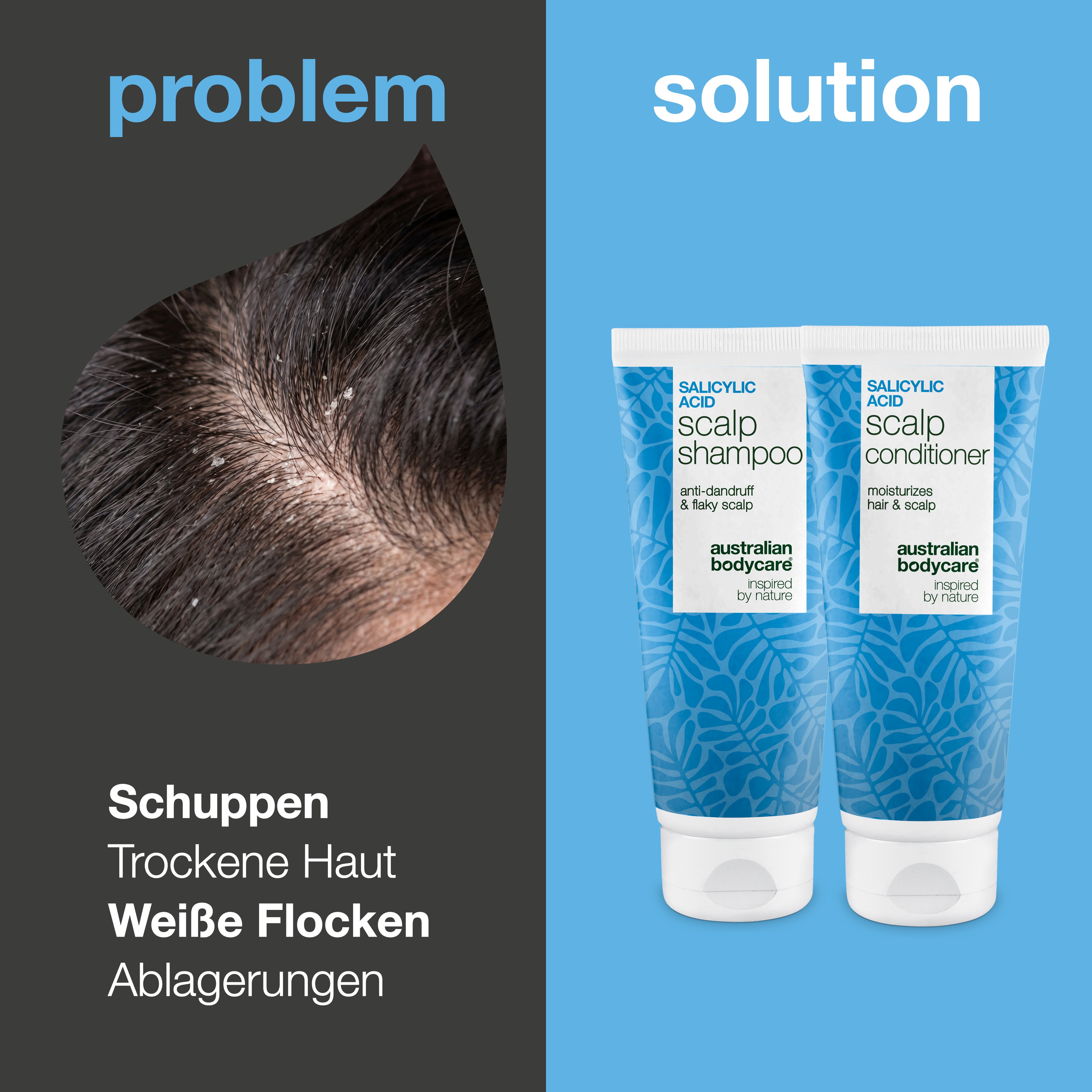 Problem und Lösung: Nahaufnahme von Schuppen und weißen Flocken auf der Kopfhaut neben Shampoo und Conditioner aus dem Set