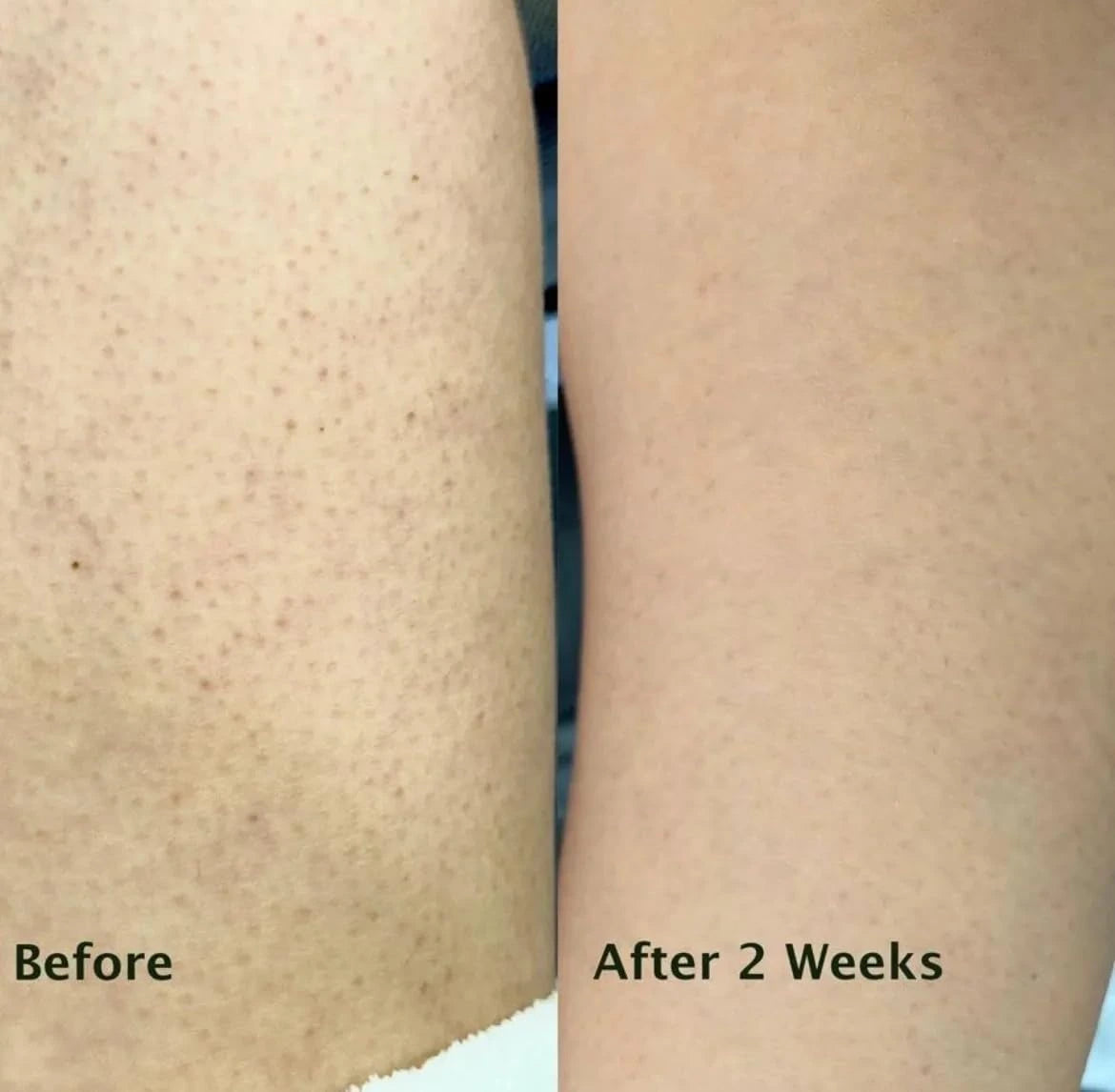 Vorher-Nachher Ergebnis – Reibeisenhaut Pflege nach 2 Wochen